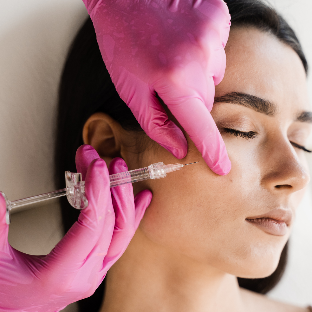 Full-face Sculptra treatment showing gradual facial volume restoration and rejuvenation at Rain Aesthetics in Glendale, AZ.