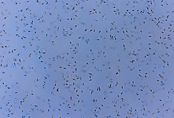Nurturing Your Path: Understanding Key Factors in Sperm Wellness