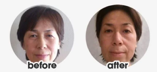 yasuyo-before-after-54 cropped.JPG