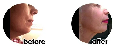 leslie-before-after cropped.JPG