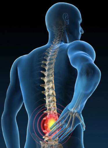 Illustration showing lower back pain with highlighted lumbar spine and nerves.