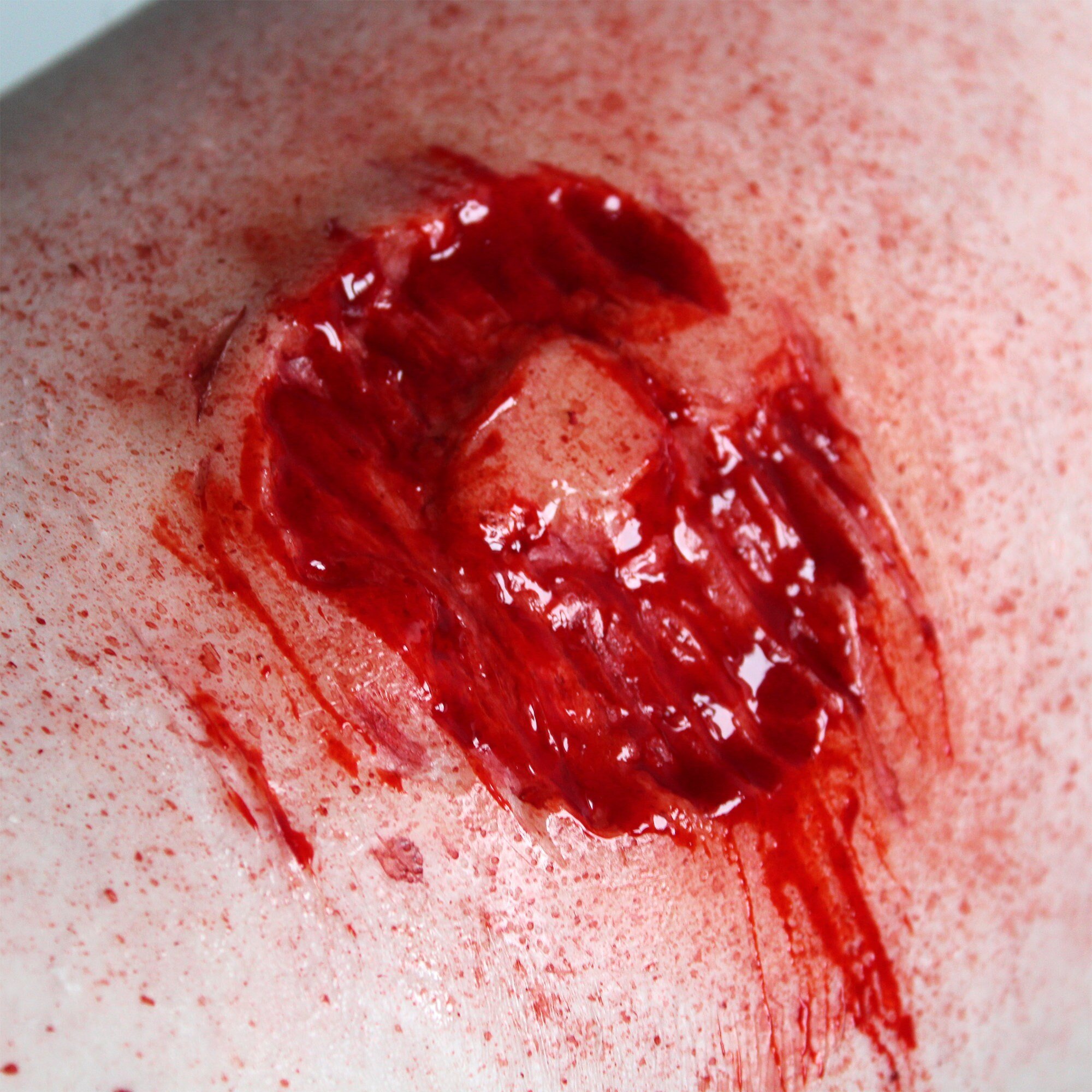 Zombie Bite