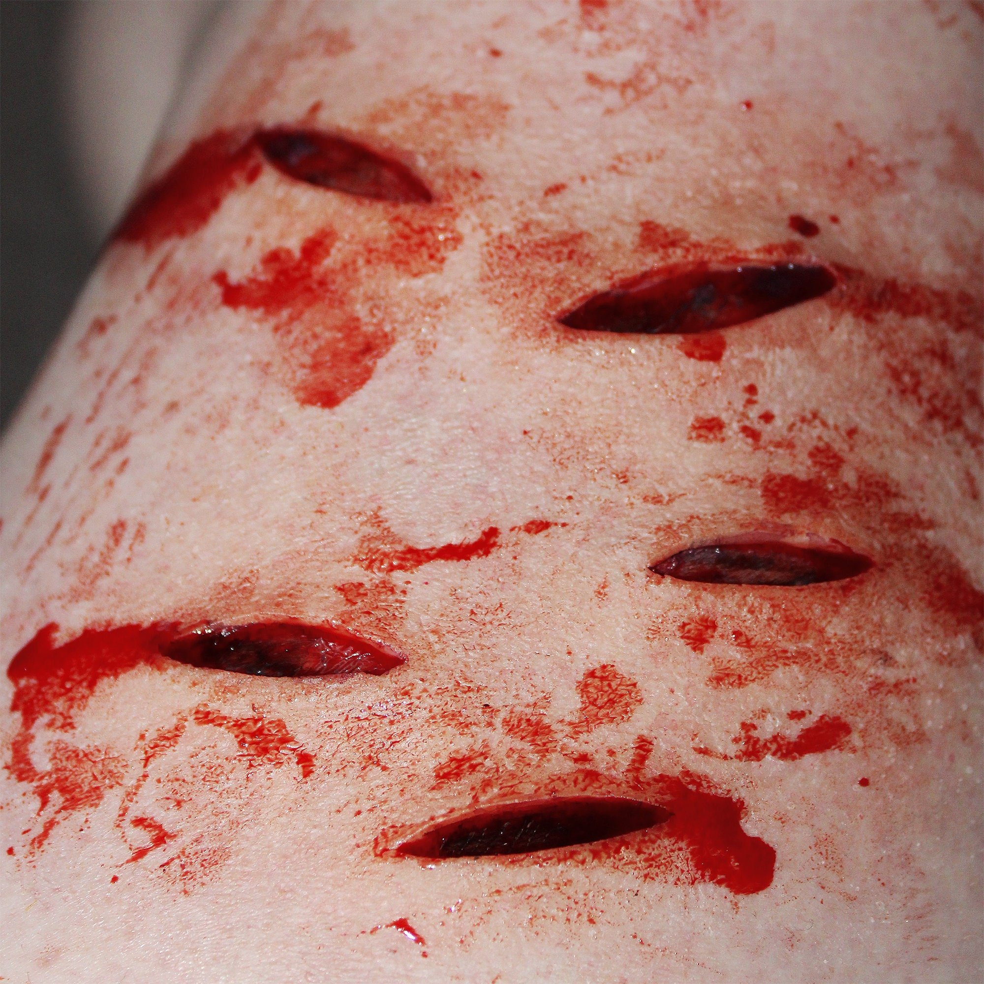 Multiple Stab wounds