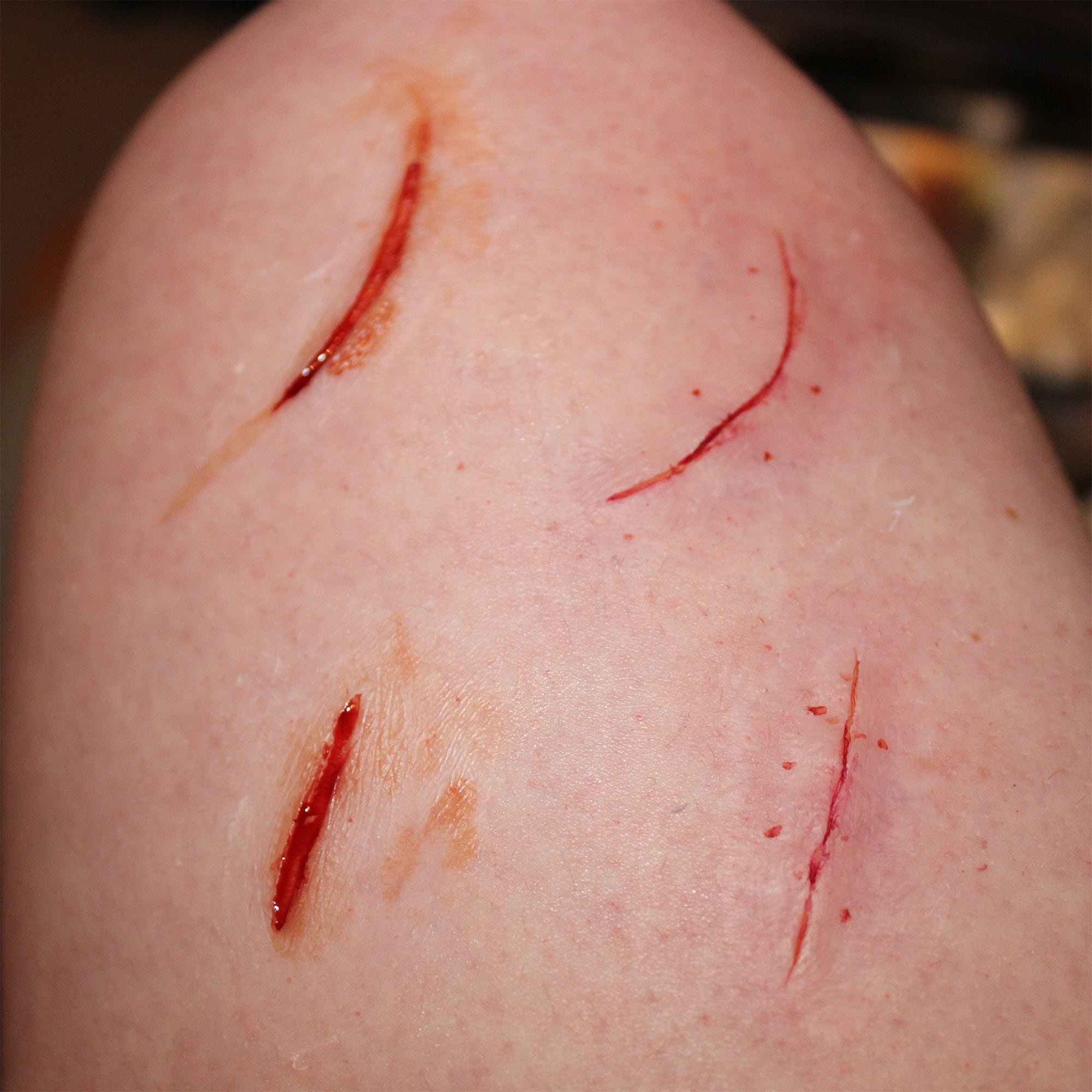 Small Cuts and Sutures
