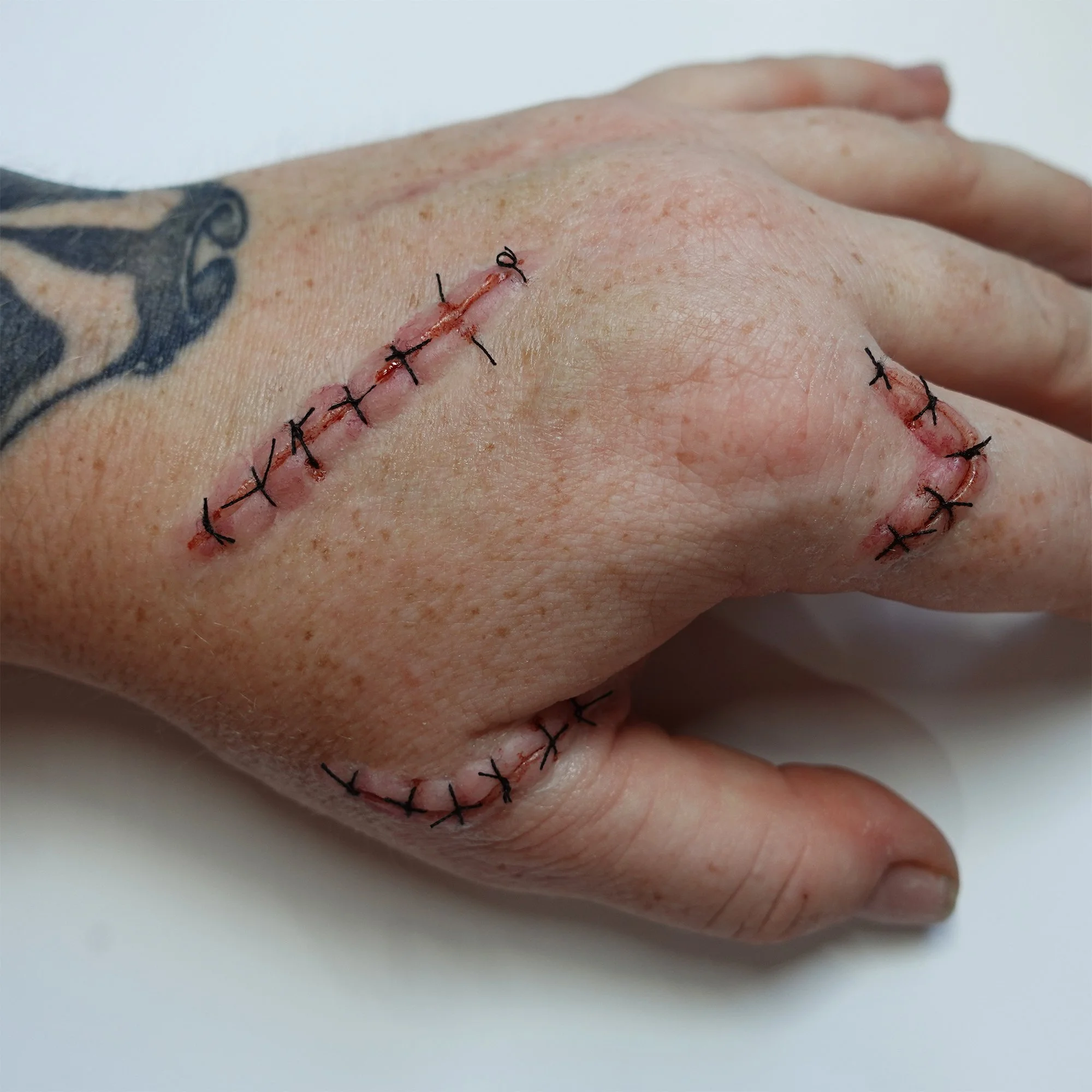 Small Suture Scars Set