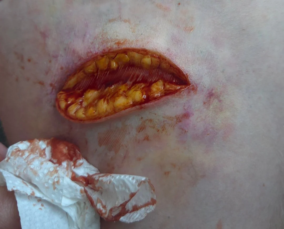 Meaty Wound 3