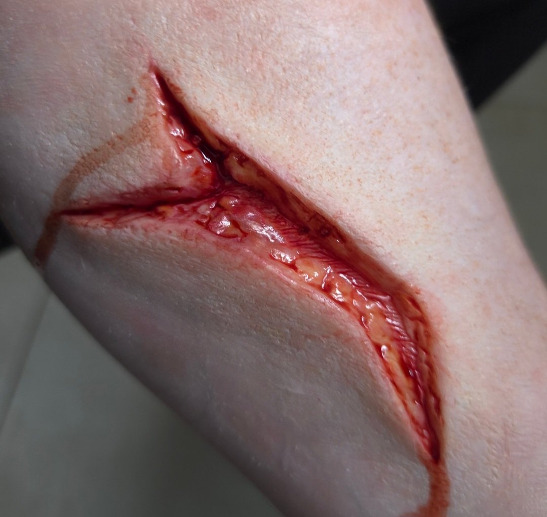 Meaty Wound 4