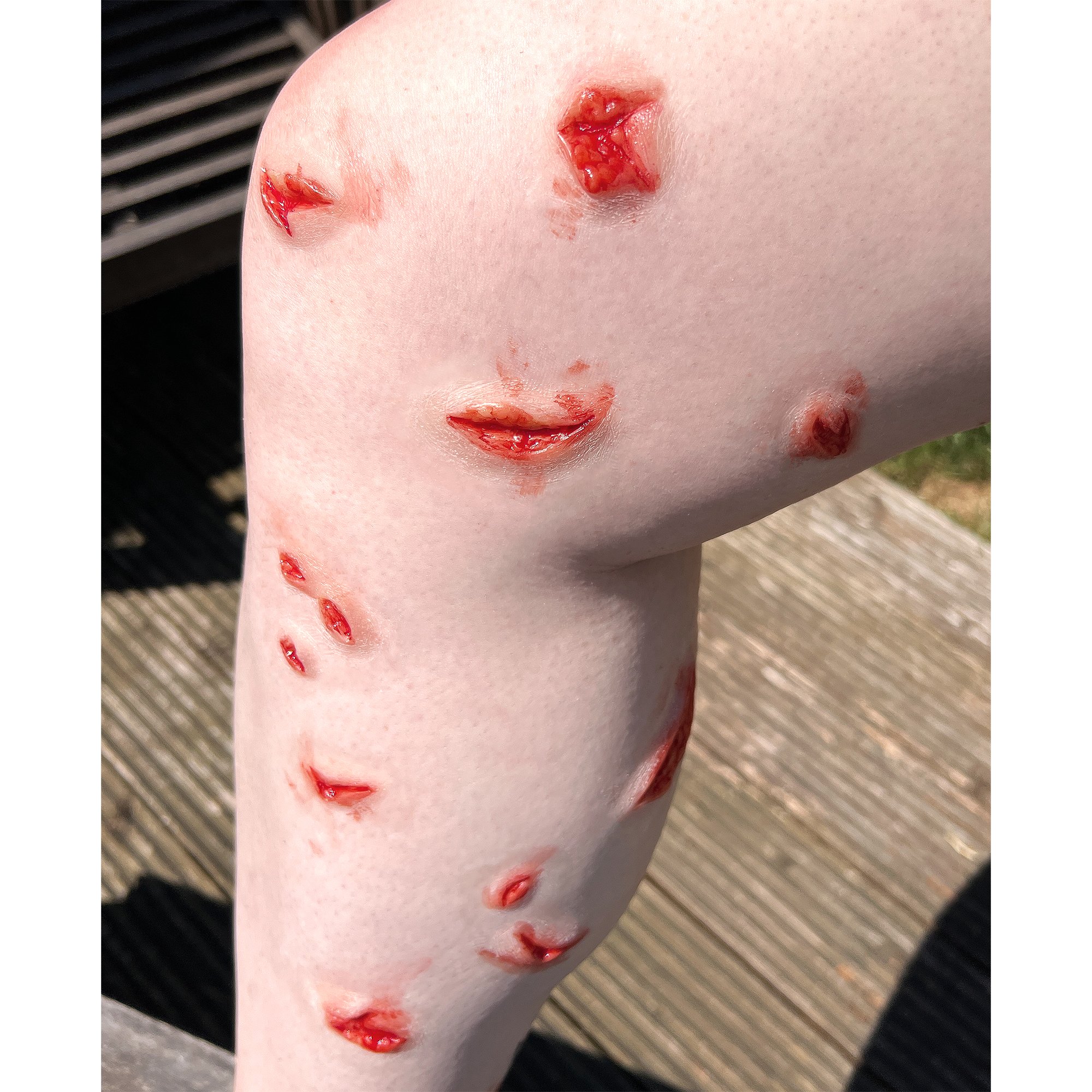 Small Wounds