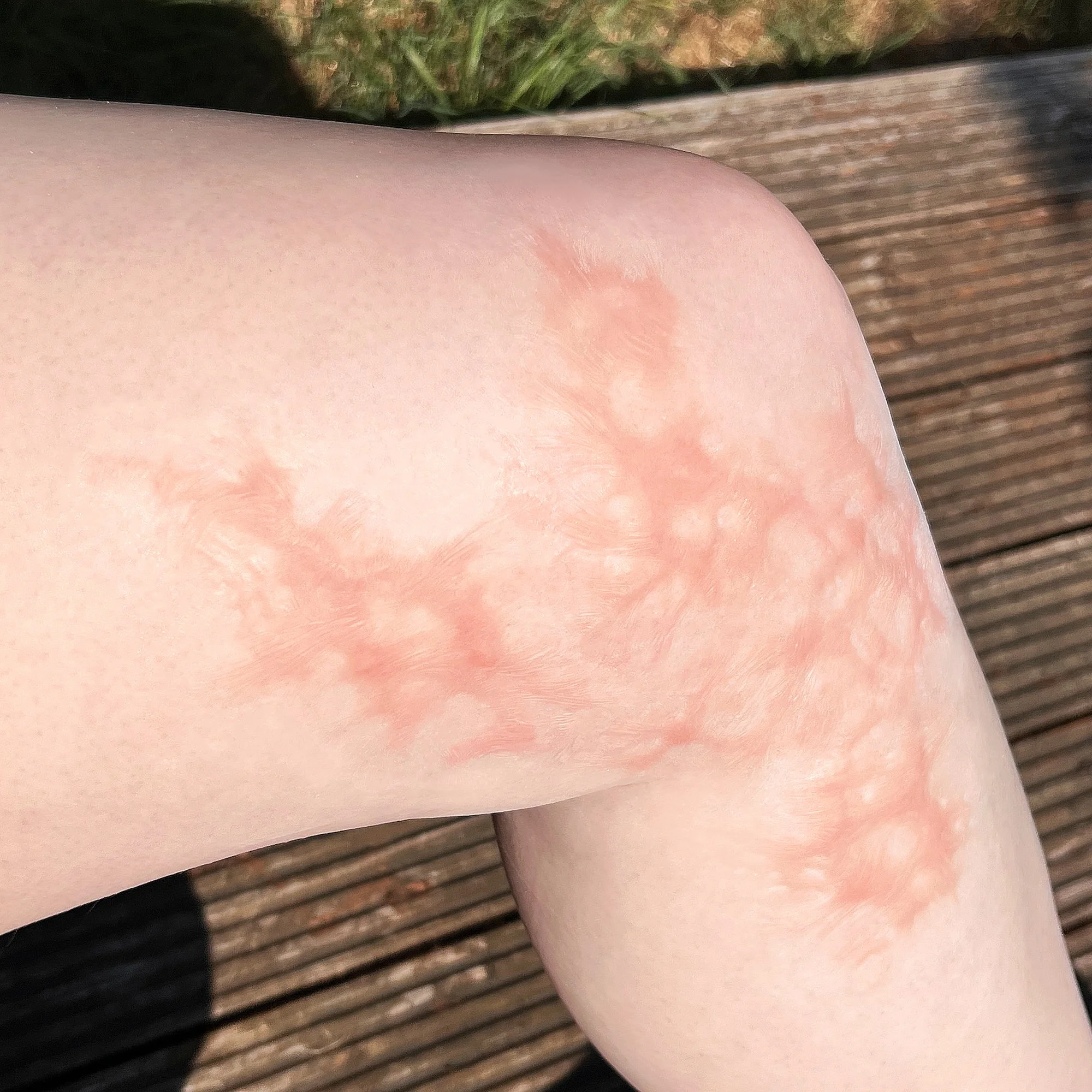 Burn Scars 2