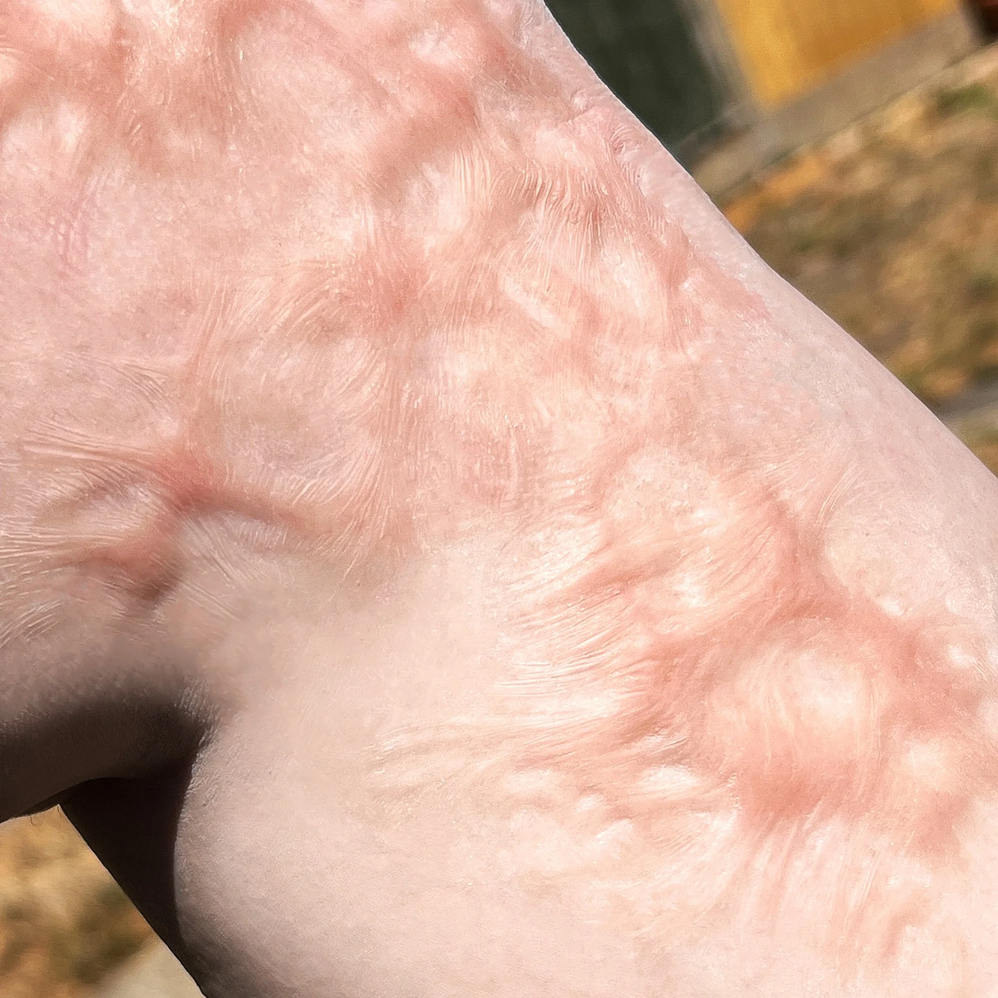 BurnScars2App3.jpg