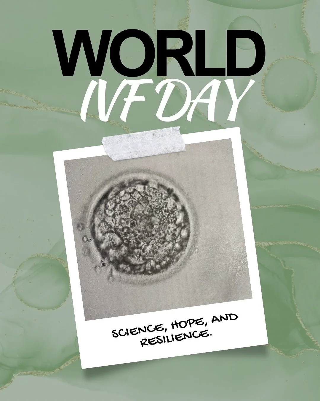 🌍💛 World IVF Day is a day of hope, resilience, and honoring the journey so many walk to build their families.
IVF isn’t easy—it takes strength, patience, and support. I know this firsthand, because I’m an IVF mama myself. The swe