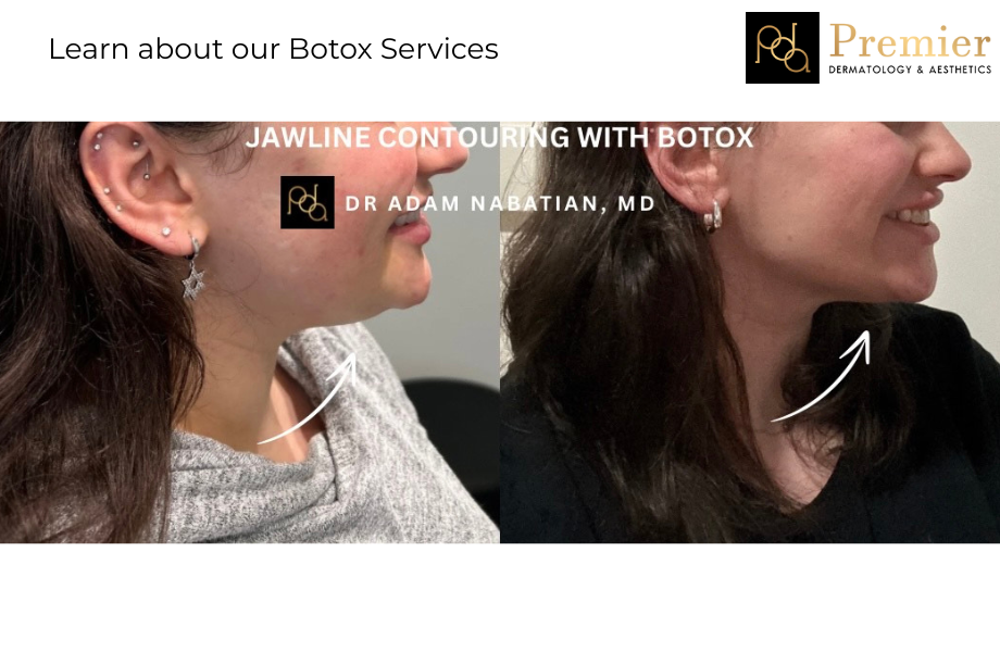 The Benefits of BOTOX® Beyond Wrinkle Reduction