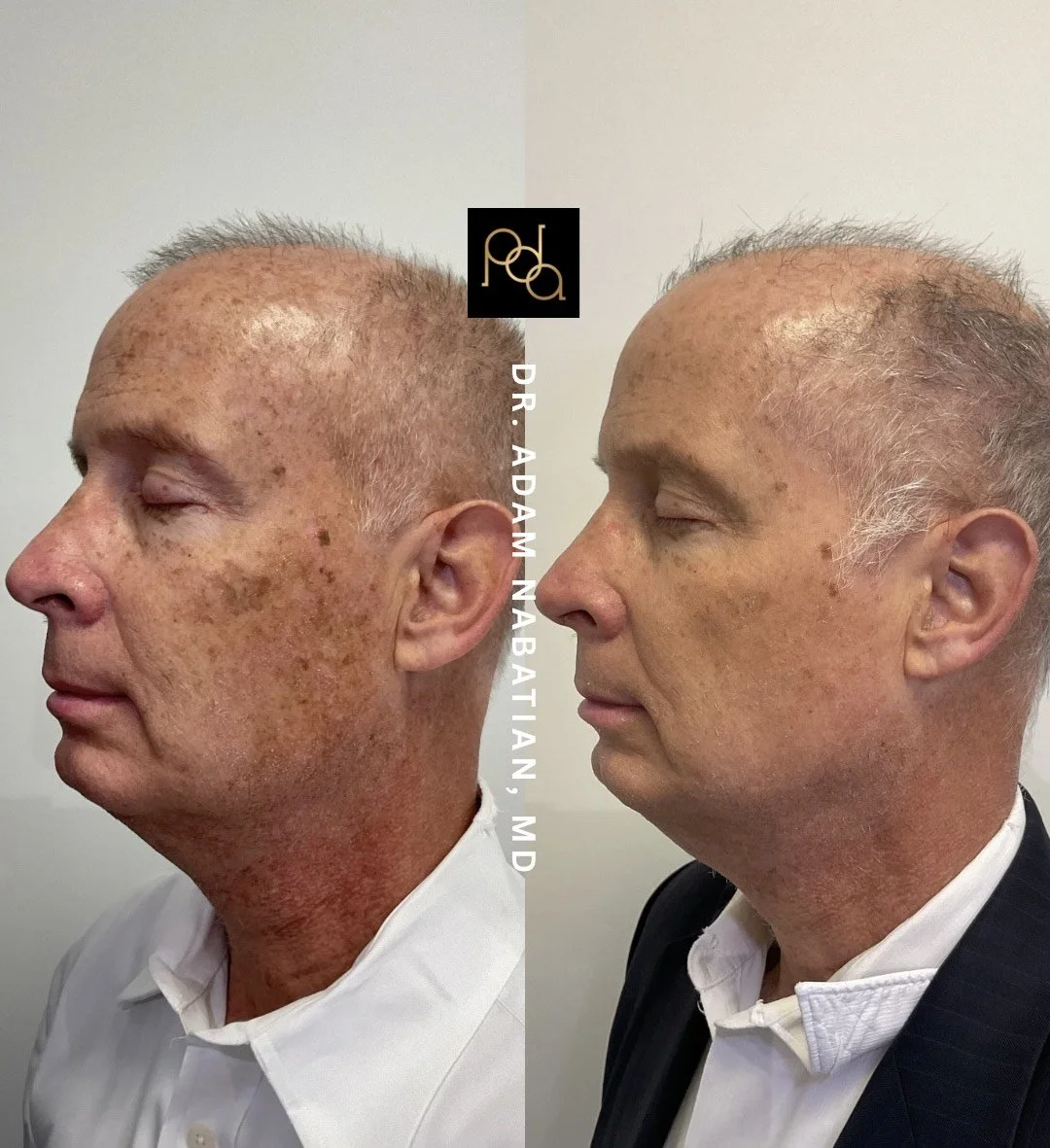 Best Anti-Aging Treatments in NYC: A Complete Guide to Looking Younger at Premier Dermatology and Aesthetics