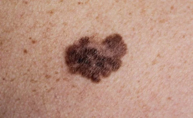 A small, dark heart-shaped tattoo on light skin with freckles.