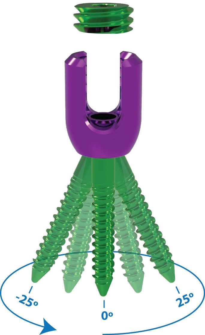 A2-4.0+%2825deg+pivot+diagram+with+marks%29.jpg