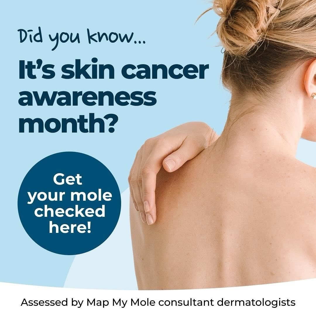 S K I N  C H E C K

&bull;

If you&rsquo;ve got a mole or lesion you&rsquo;re concerned about and would like assessing, book in online for a Map My Mole service. 

&bull;

Your report is back super quick and assessed by a consultant dermatologist. Wh