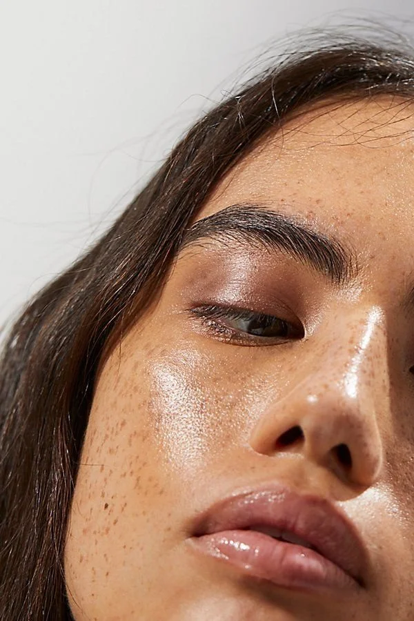 Melasma Vs Hyperpigmentation – What’s the difference and how can you treatthem?