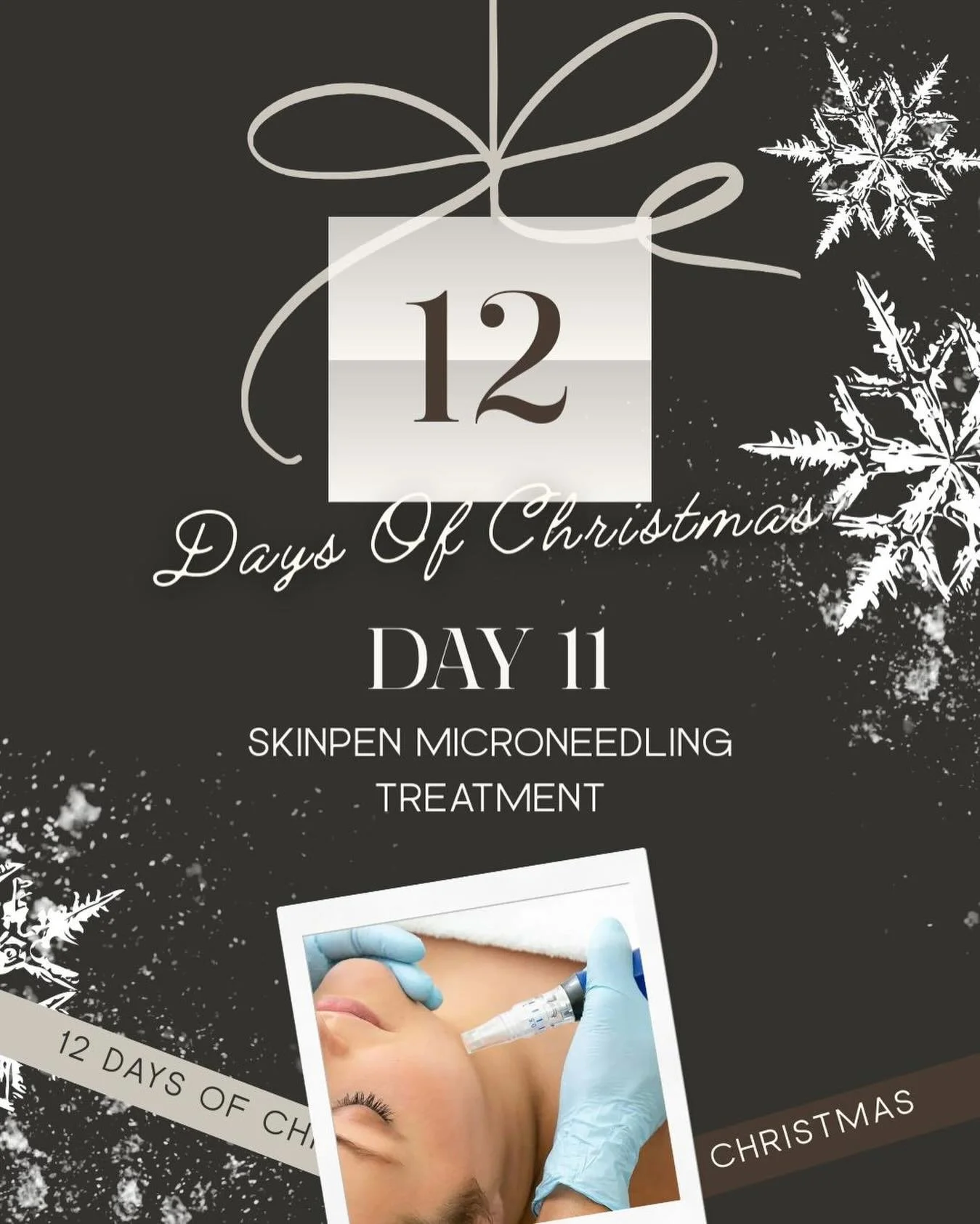 D A Y  1 1

&bull;

We&rsquo;re almost at the end and today is one of my favourite collagen banking treatments. 

✨ Like the post 
✨ Tag a friend 
✨ Follow the page 

Good luck! 

#giveaway #skinpen #skinclinic #collagenbanking
