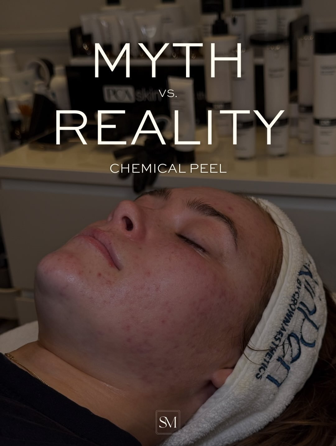 Chemical peels definitely strike the fear in to some people. Images like Samantha in Sex and the City leave people worried their whole face is going to peel off in one sheet! While there are peels out there that can do this, the vast majority are mil