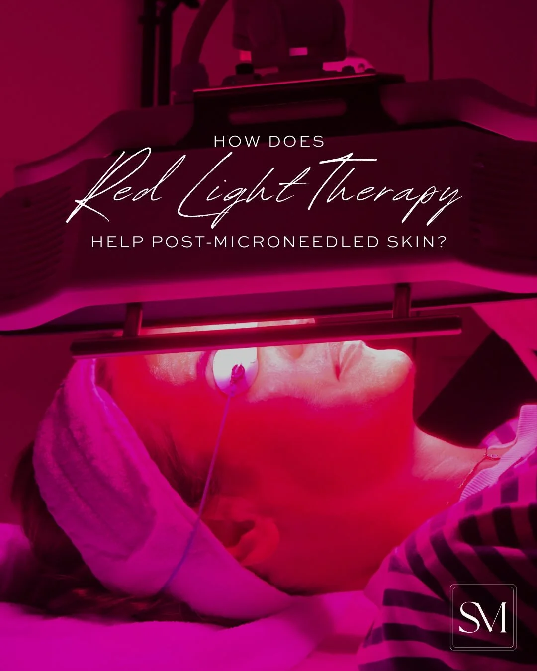 @skinpen_uk 🤝 @dermaluxled 

The perfect addition to help reduce downtime, maximise results and improve absorption. 

#dermalux #skinpen #collagenbanking #skinclinic #birmingham