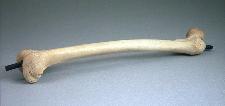 daws_femur.jpg