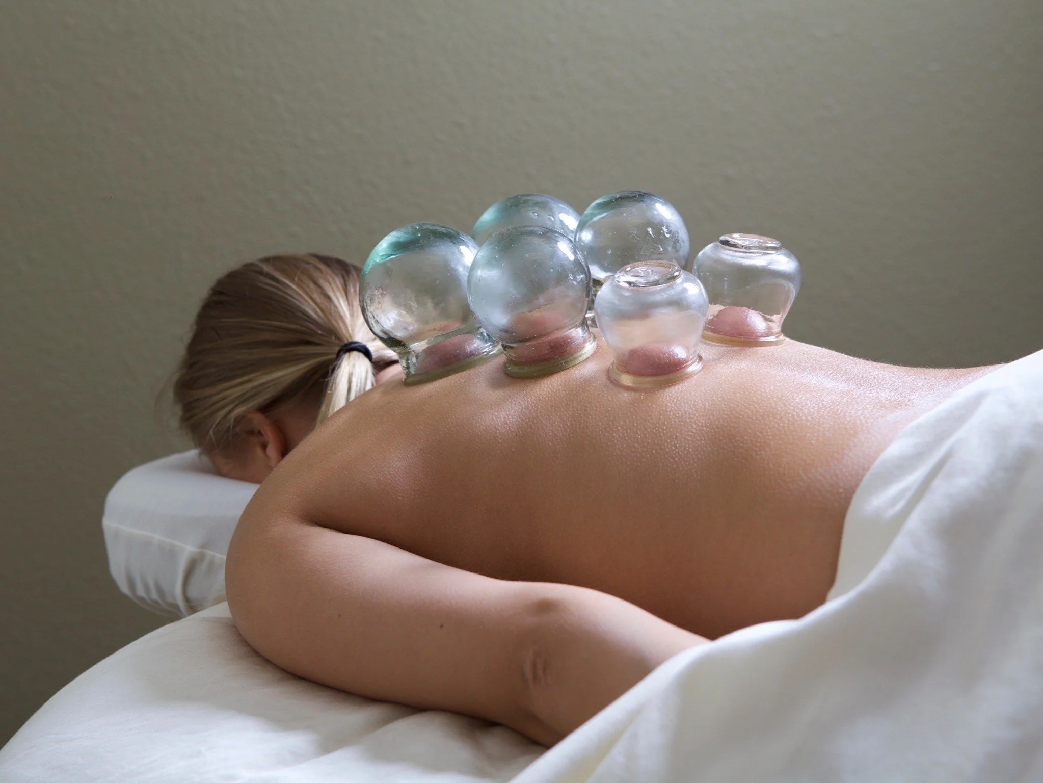 Cupping Process Cupping Therapy & Massage | Chad Daley LMT
