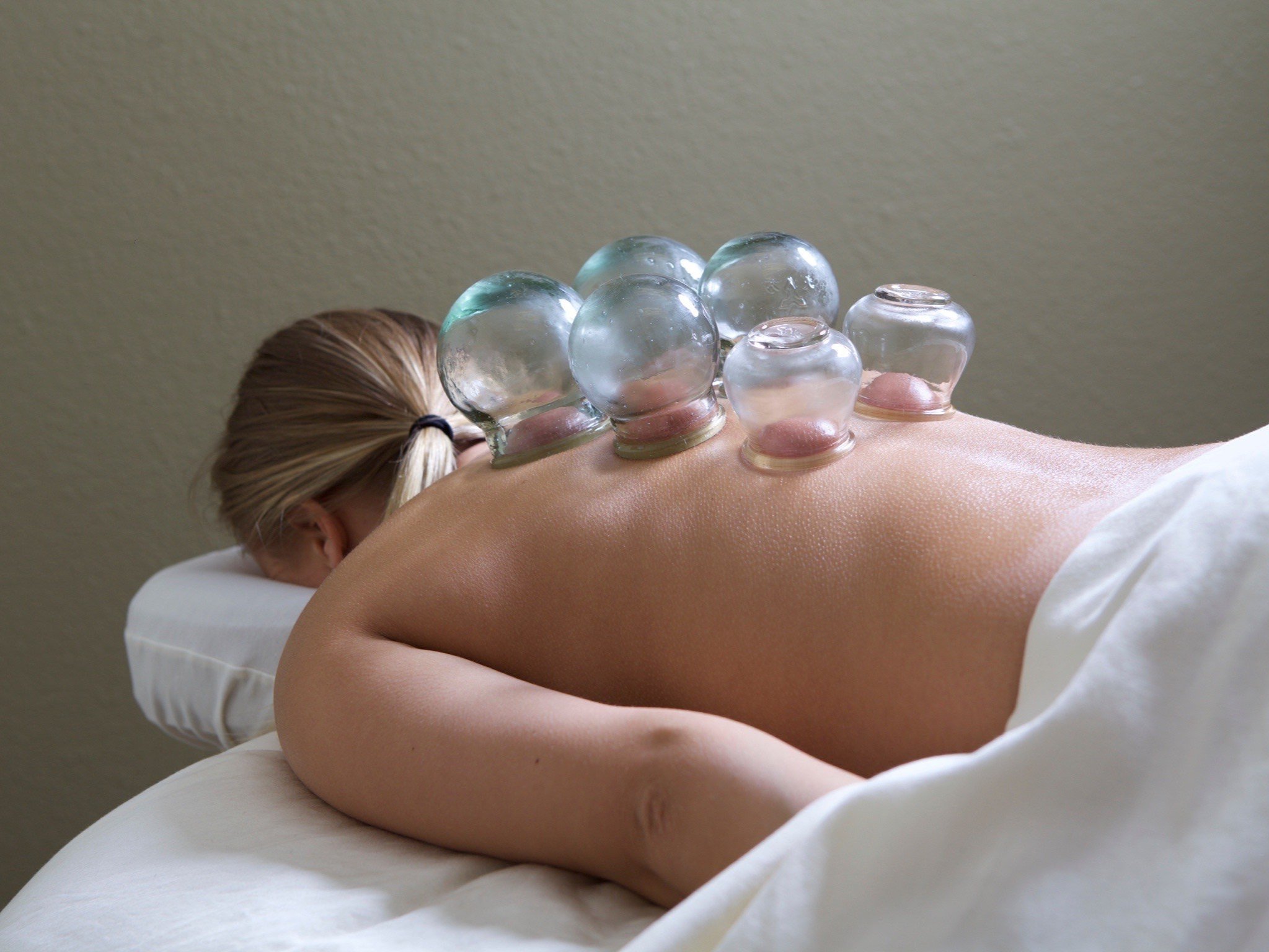 Cupping Therapy & Massage | Chad Daley LMT