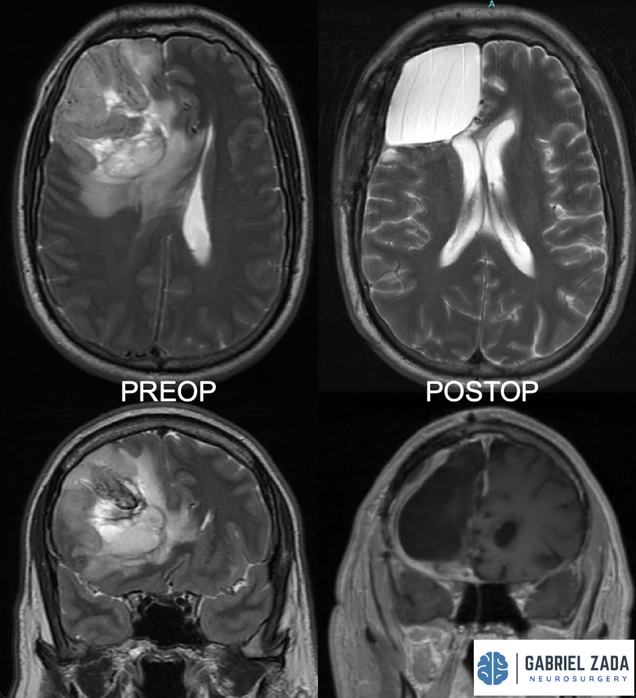 Screenshot 2026-03-09 at 1.47.56 PM.png