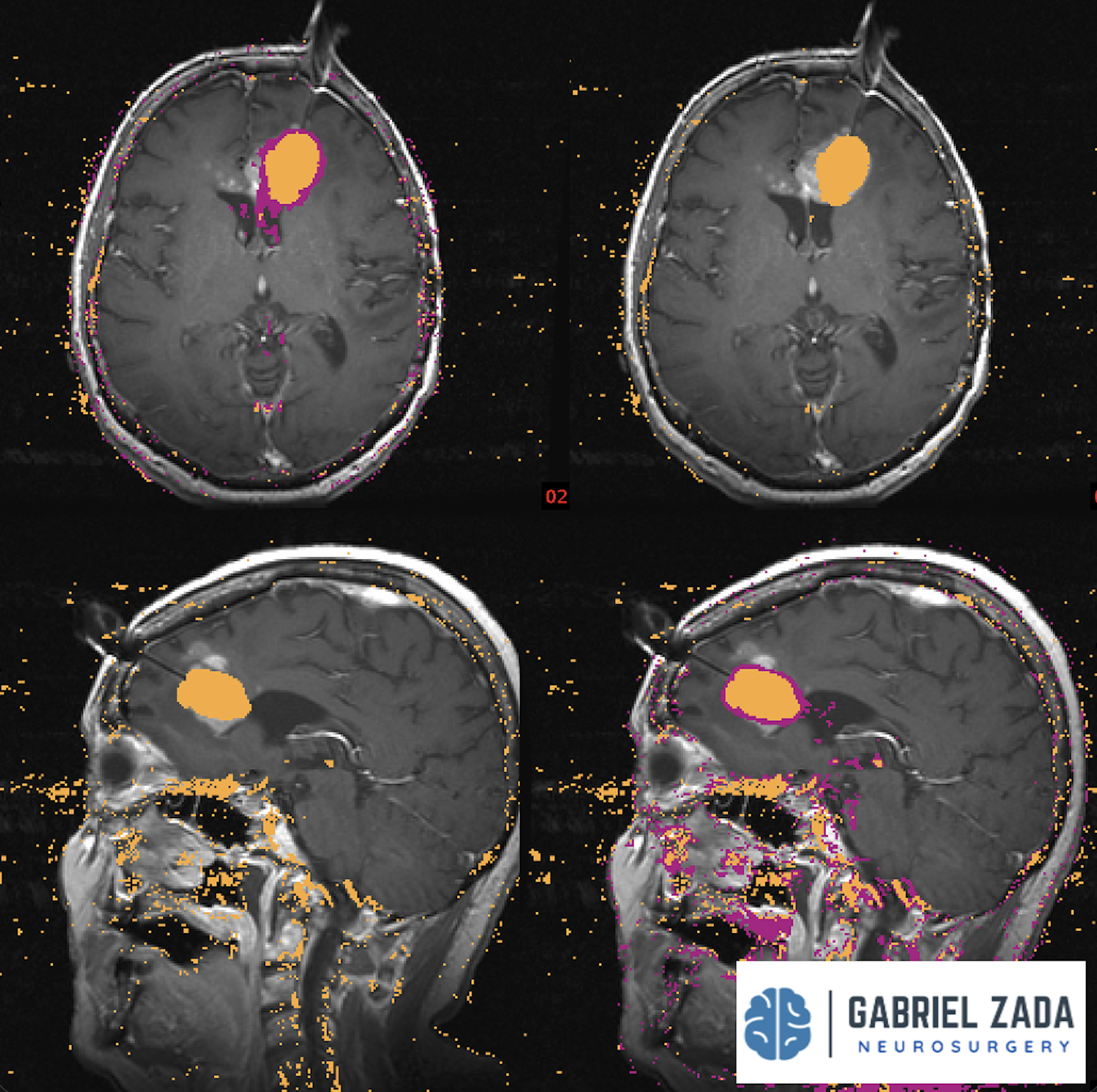 Screenshot 2026-03-09 at 1.51.05 PM.png