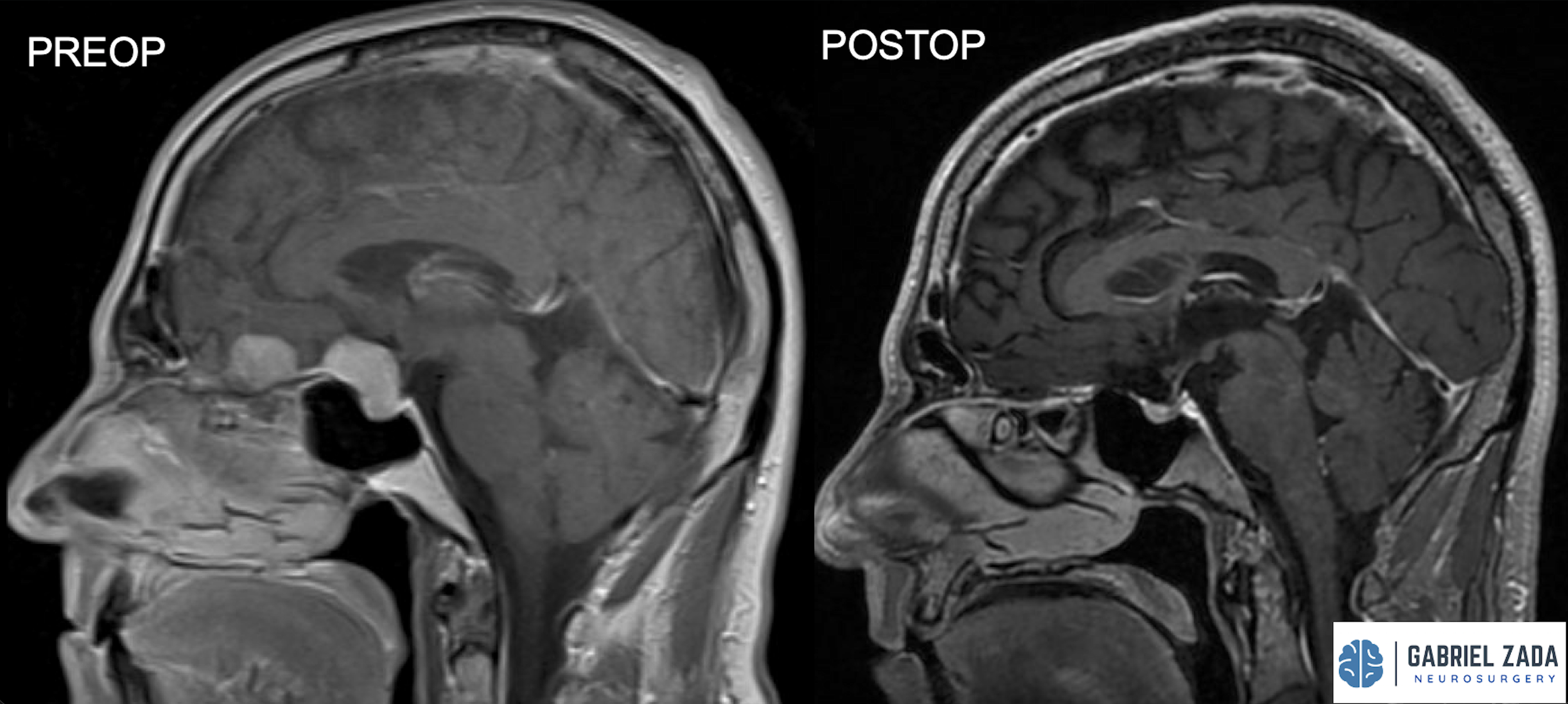 Screenshot 2026-03-09 at 1.57.05 PM.png