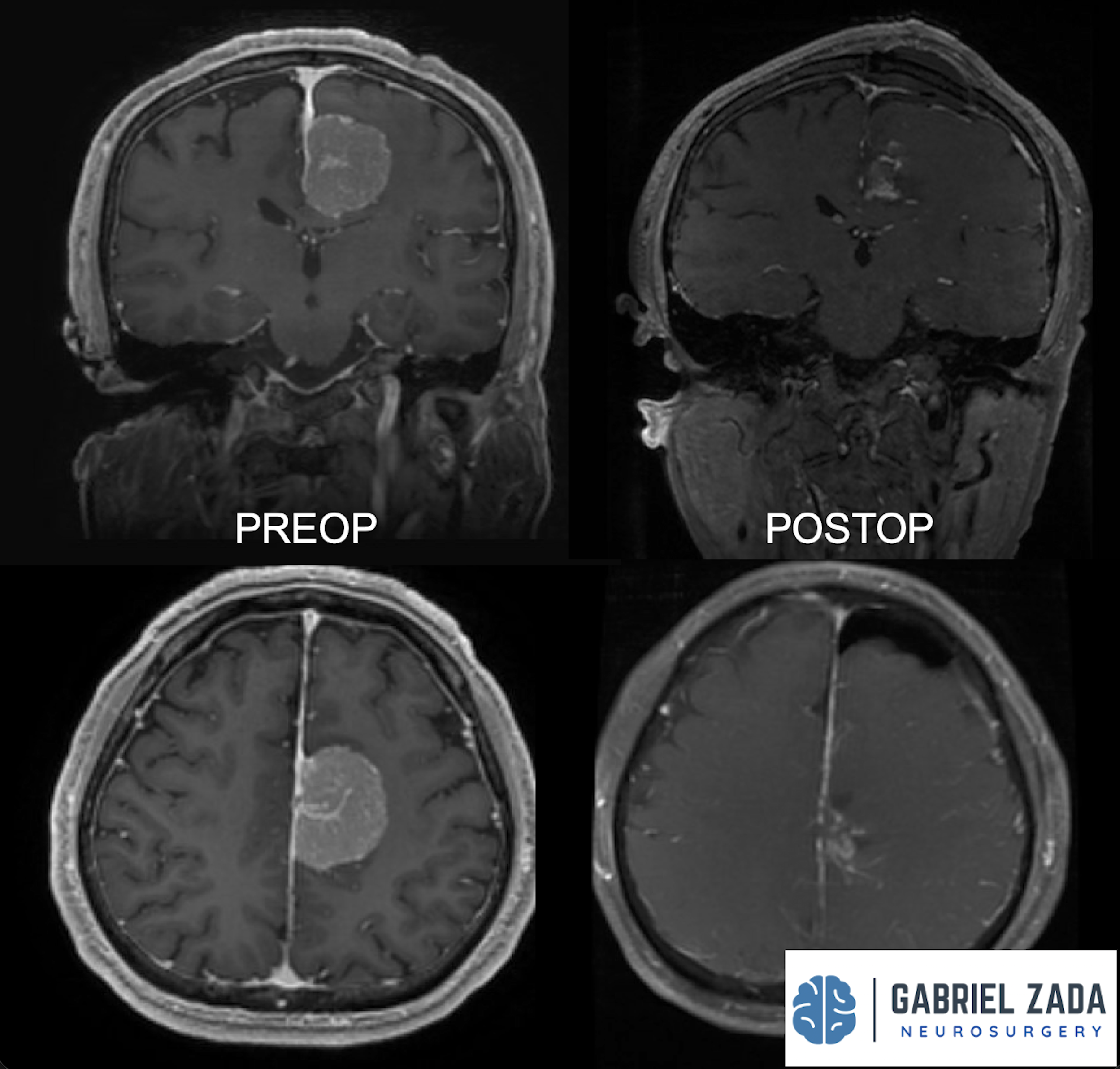 Screenshot 2026-03-09 at 1.56.17 PM.png