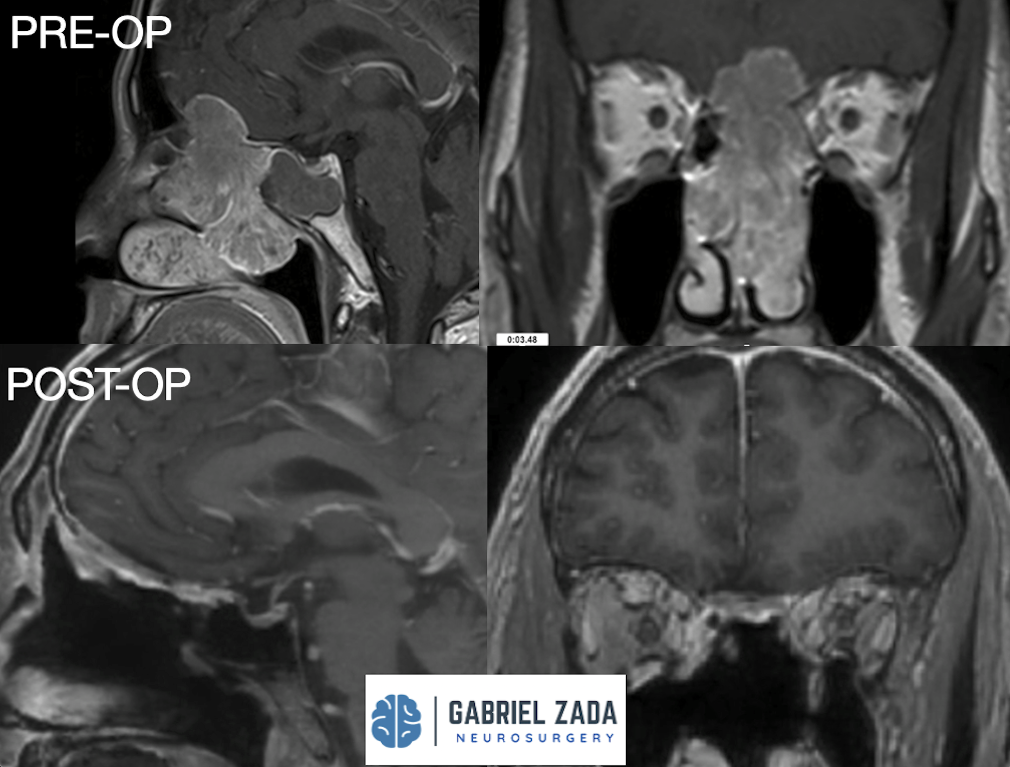 Screenshot 2026-03-09 at 2.06.32 PM.png