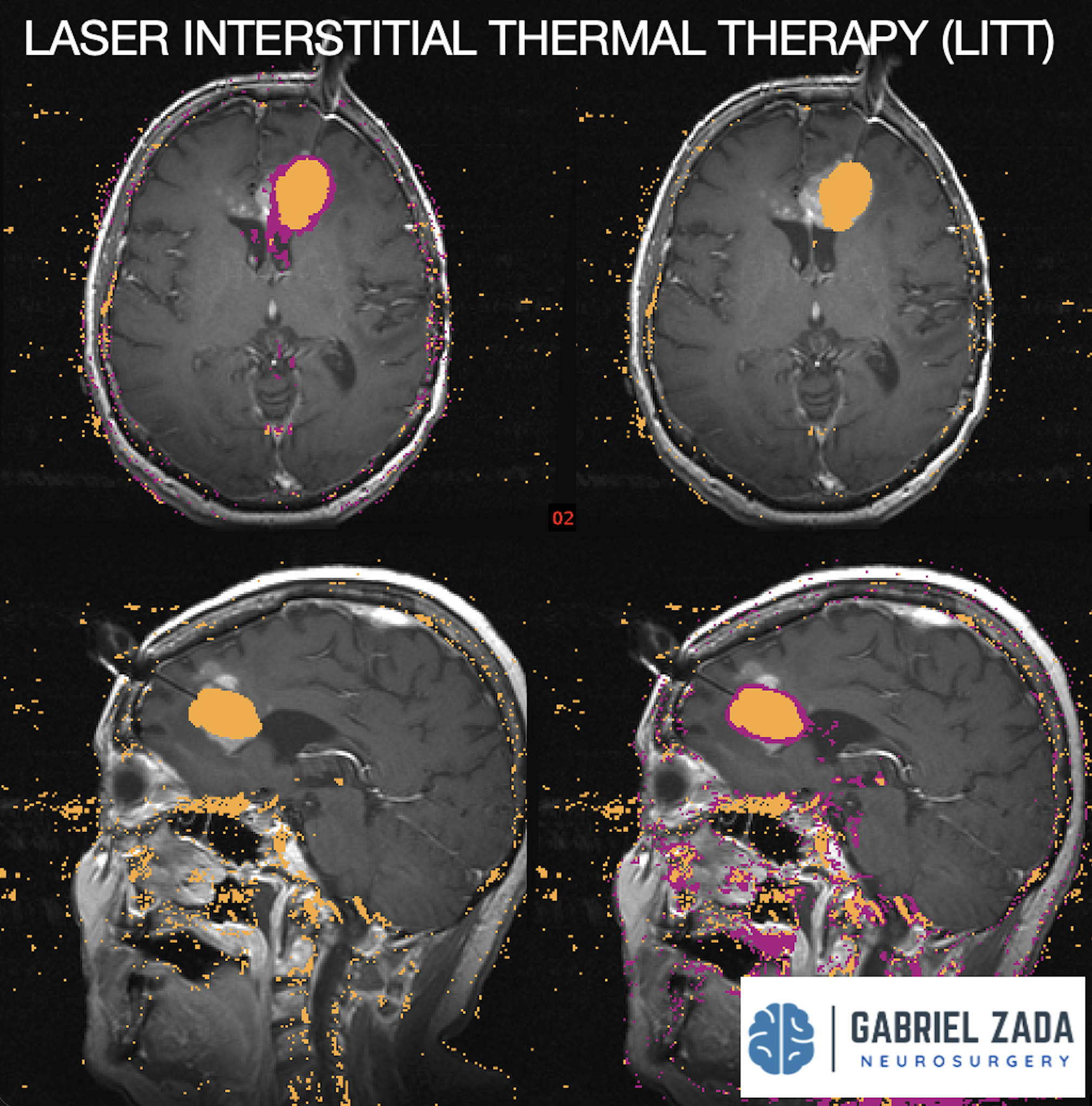 Screenshot 2026-03-09 at 1.51.15 PM.png