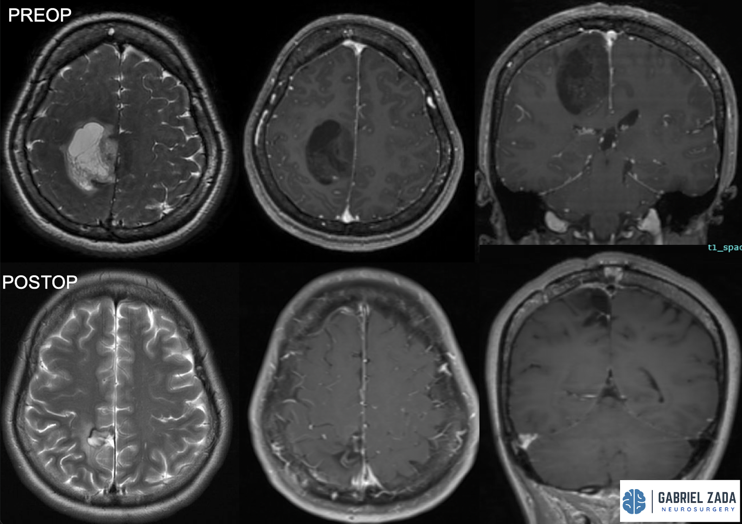 Screenshot 2026-03-09 at 1.48.38 PM.png