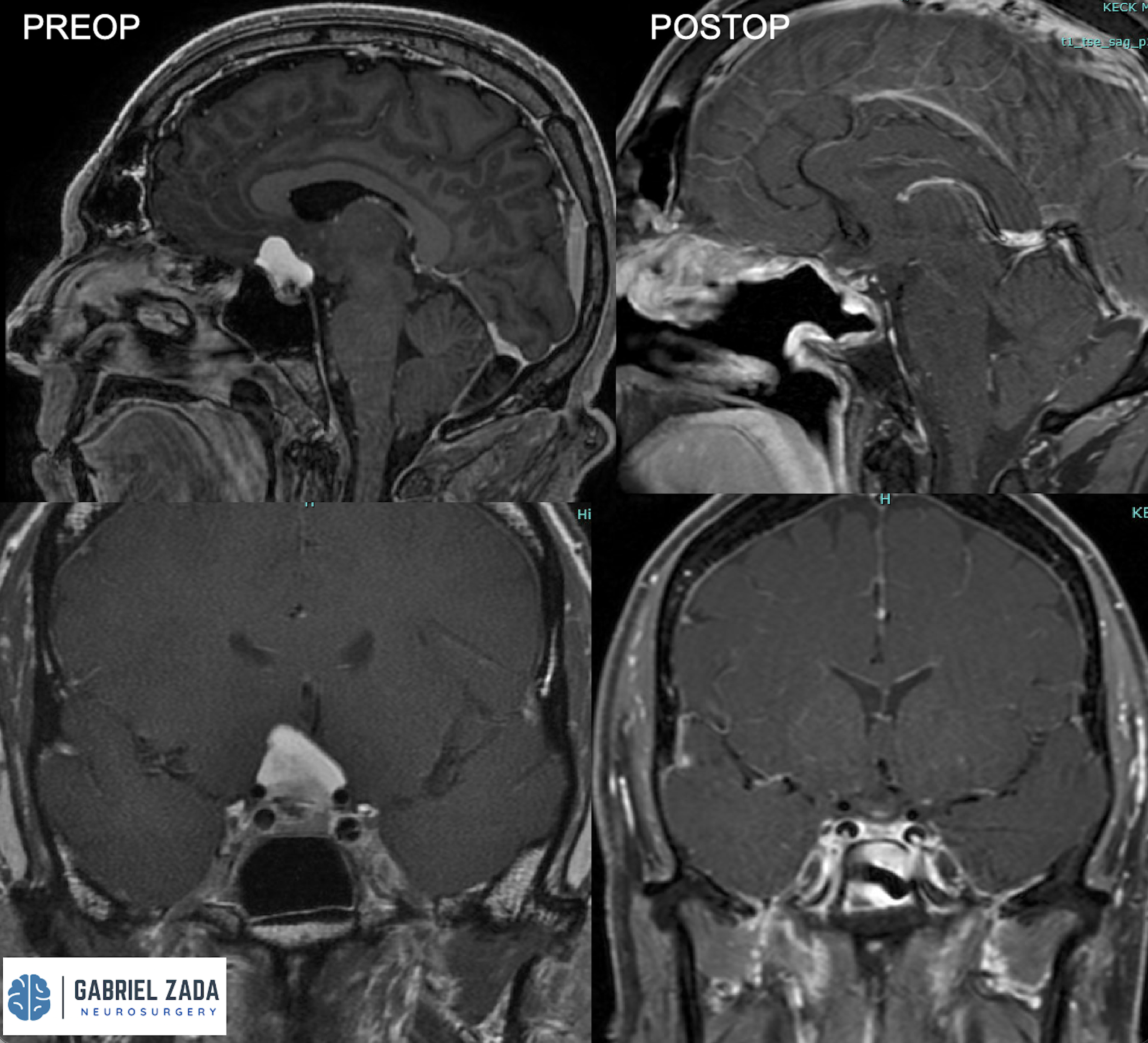 Screenshot 2026-03-09 at 2.12.40 PM.png