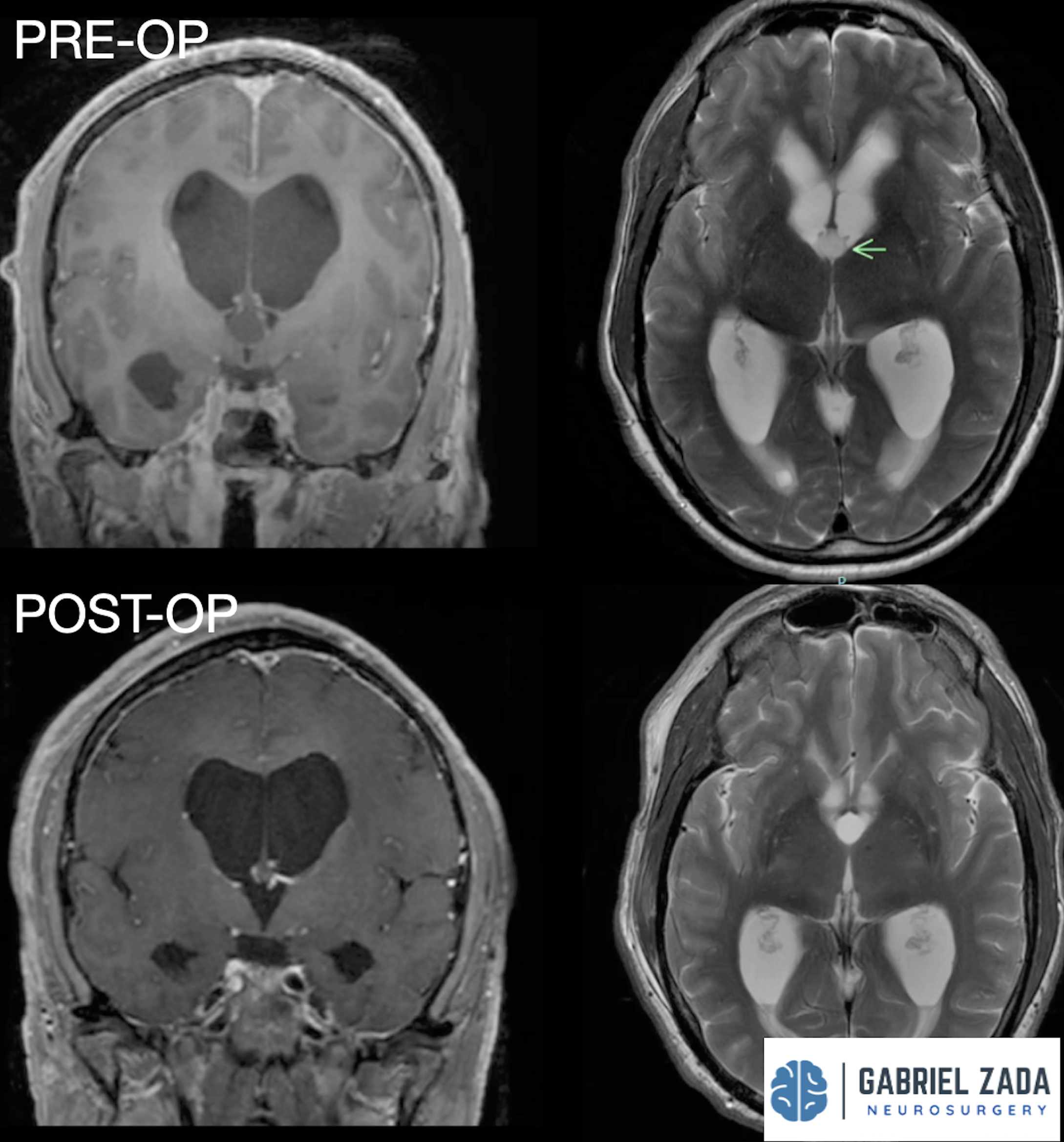 Screenshot 2026-03-09 at 2.05.38 PM.png