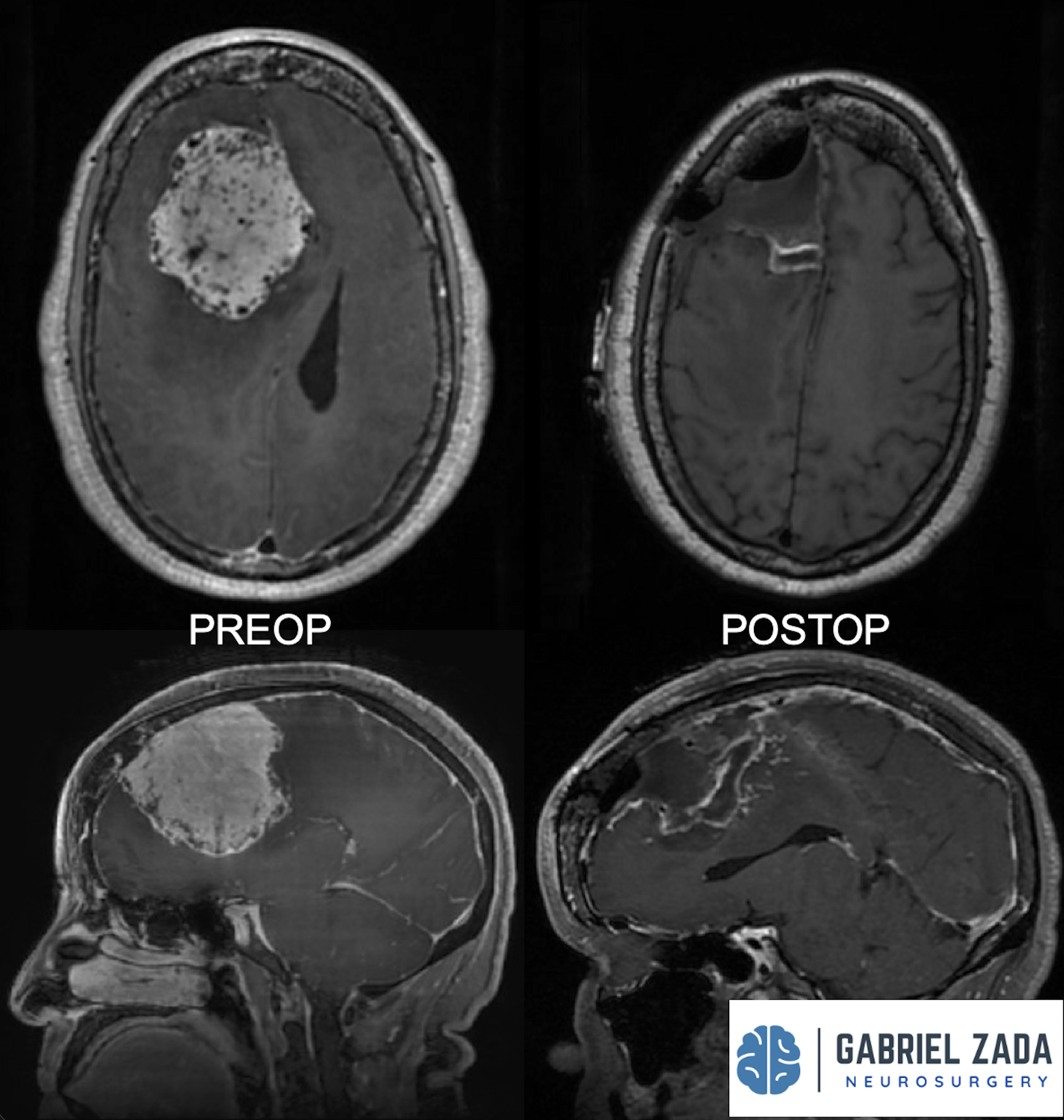 Screenshot 2026-03-09 at 1.56.06 PM.png