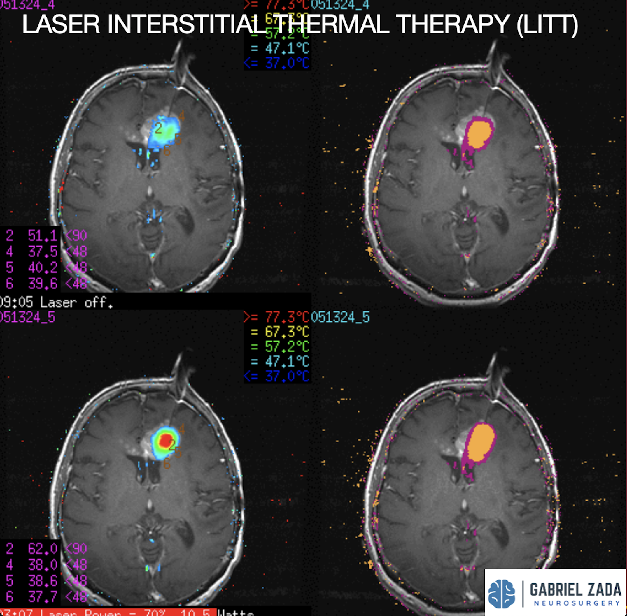 Screenshot 2026-03-09 at 1.51.25 PM.png