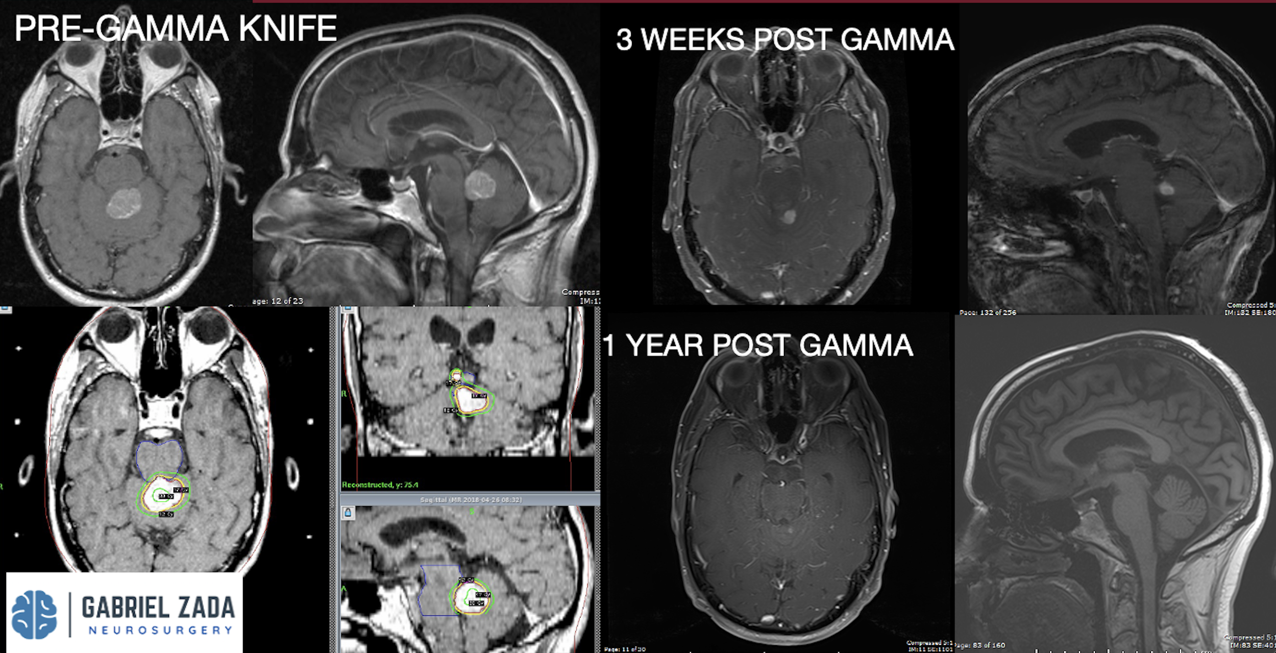 Screenshot 2026-03-09 at 2.04.42 PM.png