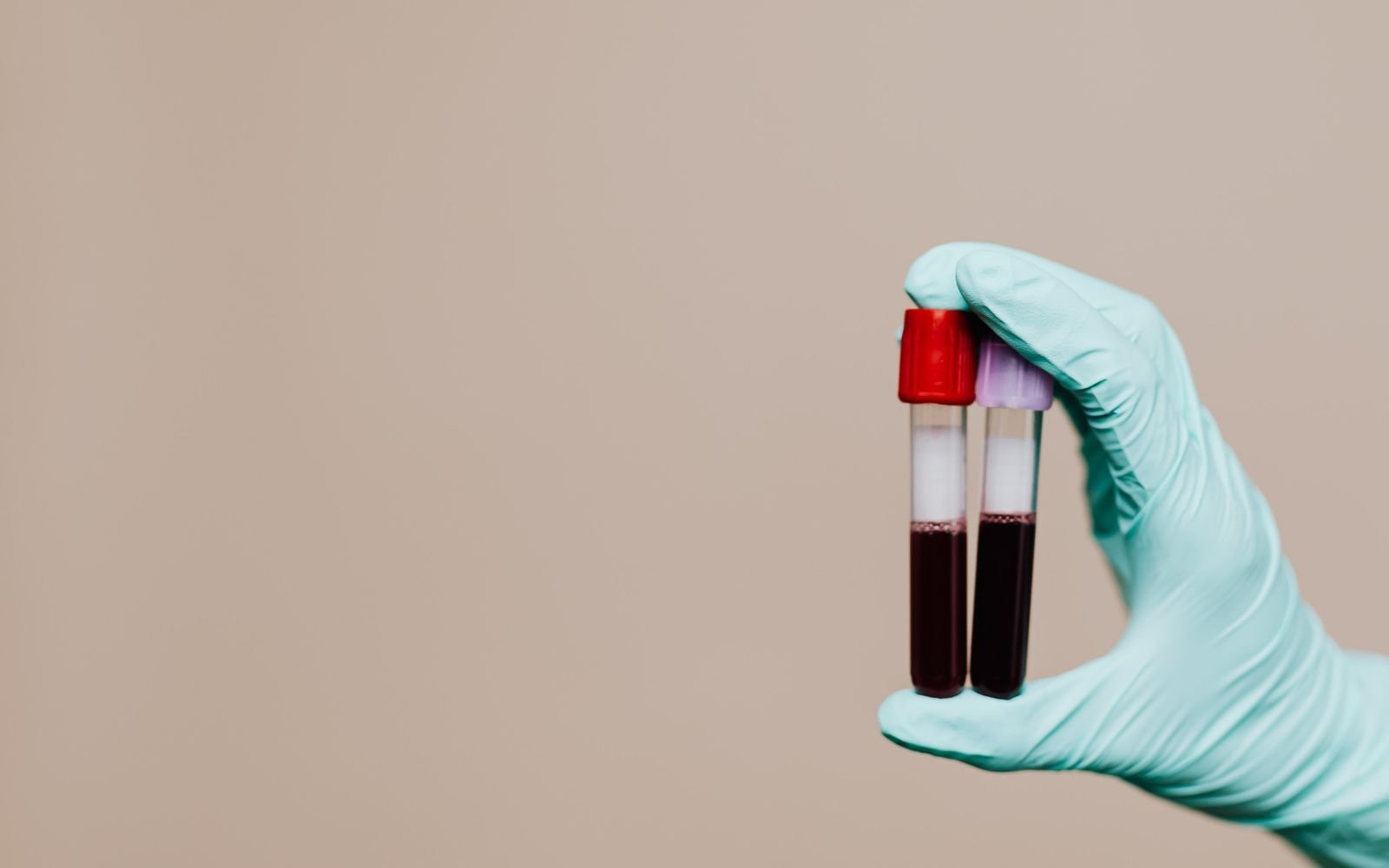What Is Functional Health Testing? A Naturopath's Guide
