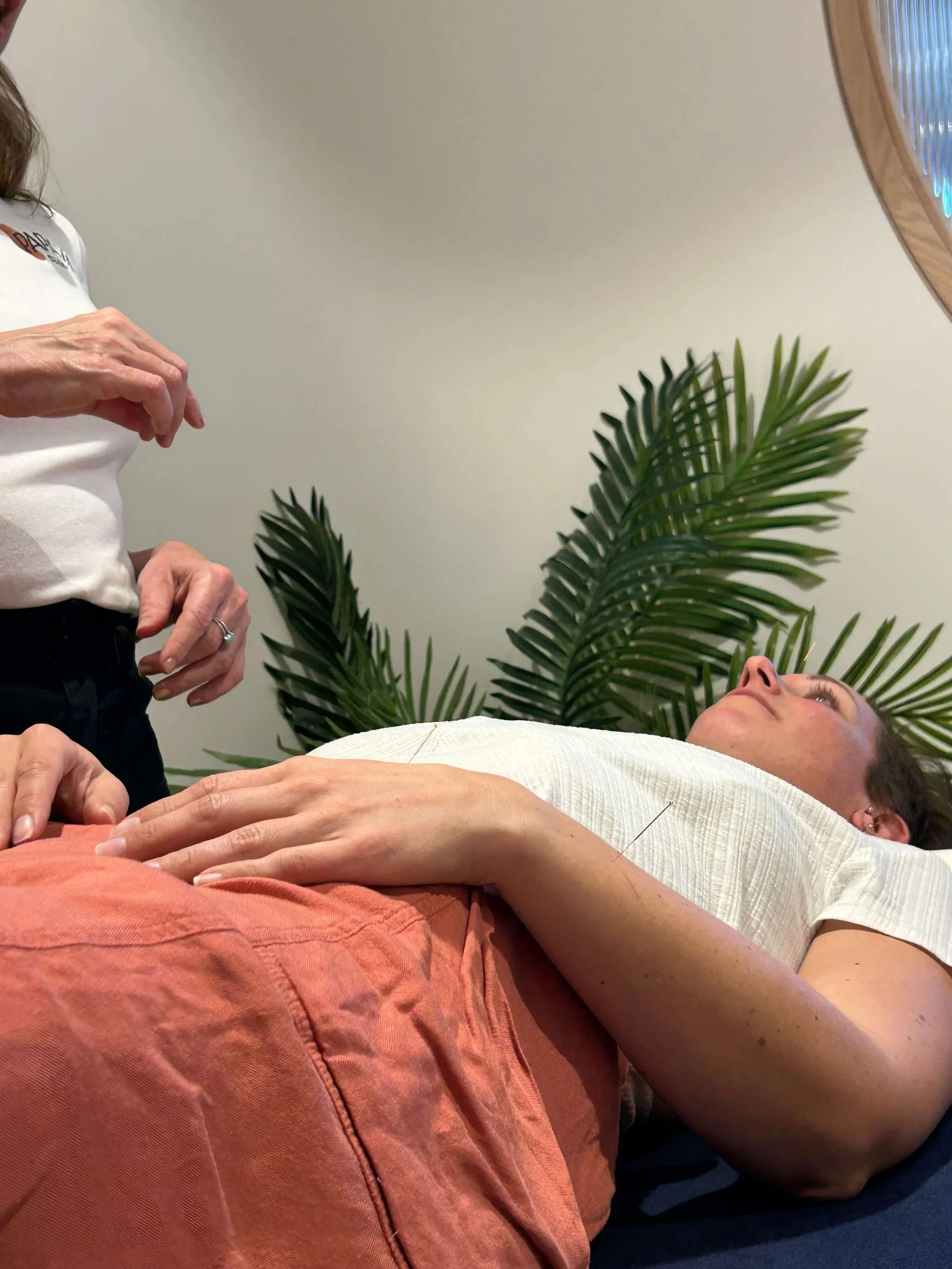 Acupuncture for fertility 