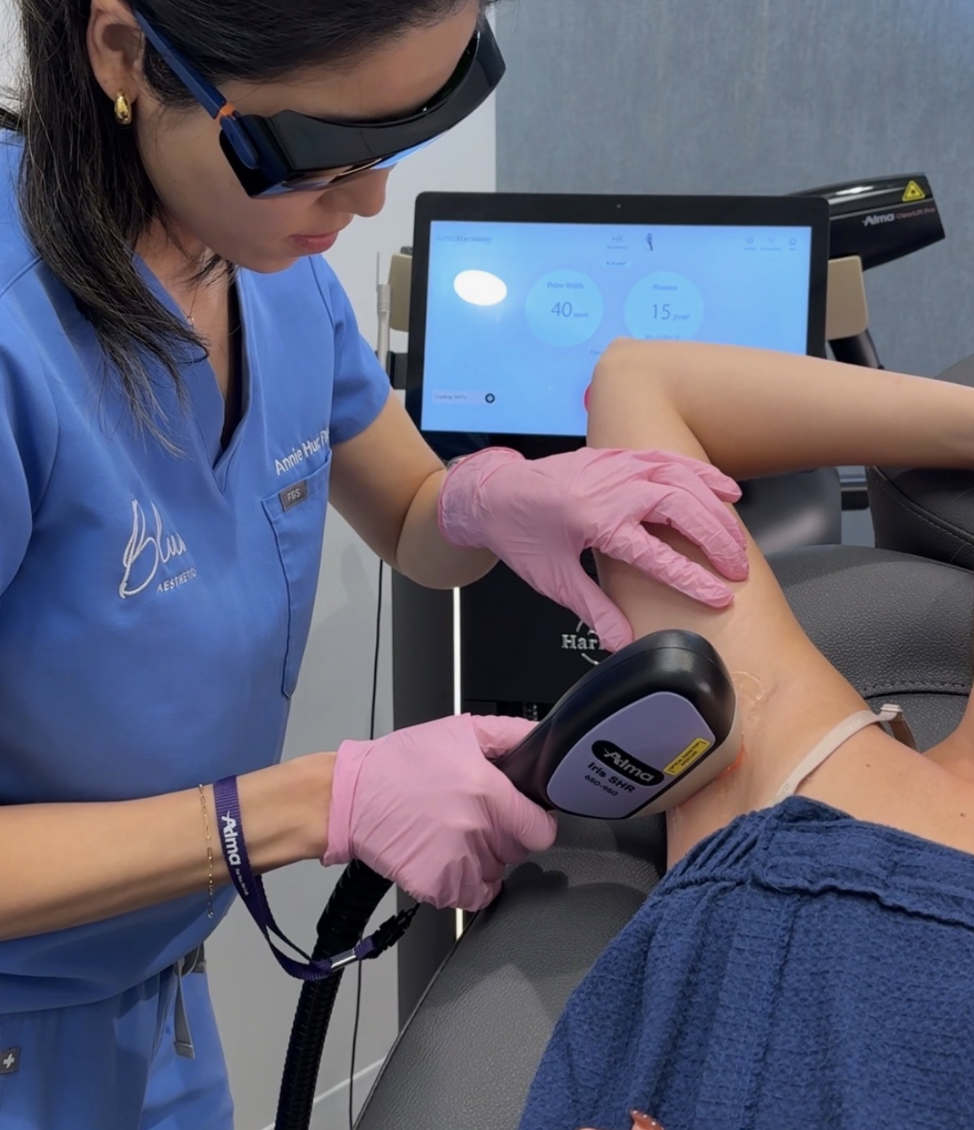 Laser hair removal treatment at Blue Aesthetics in Arlington, VA