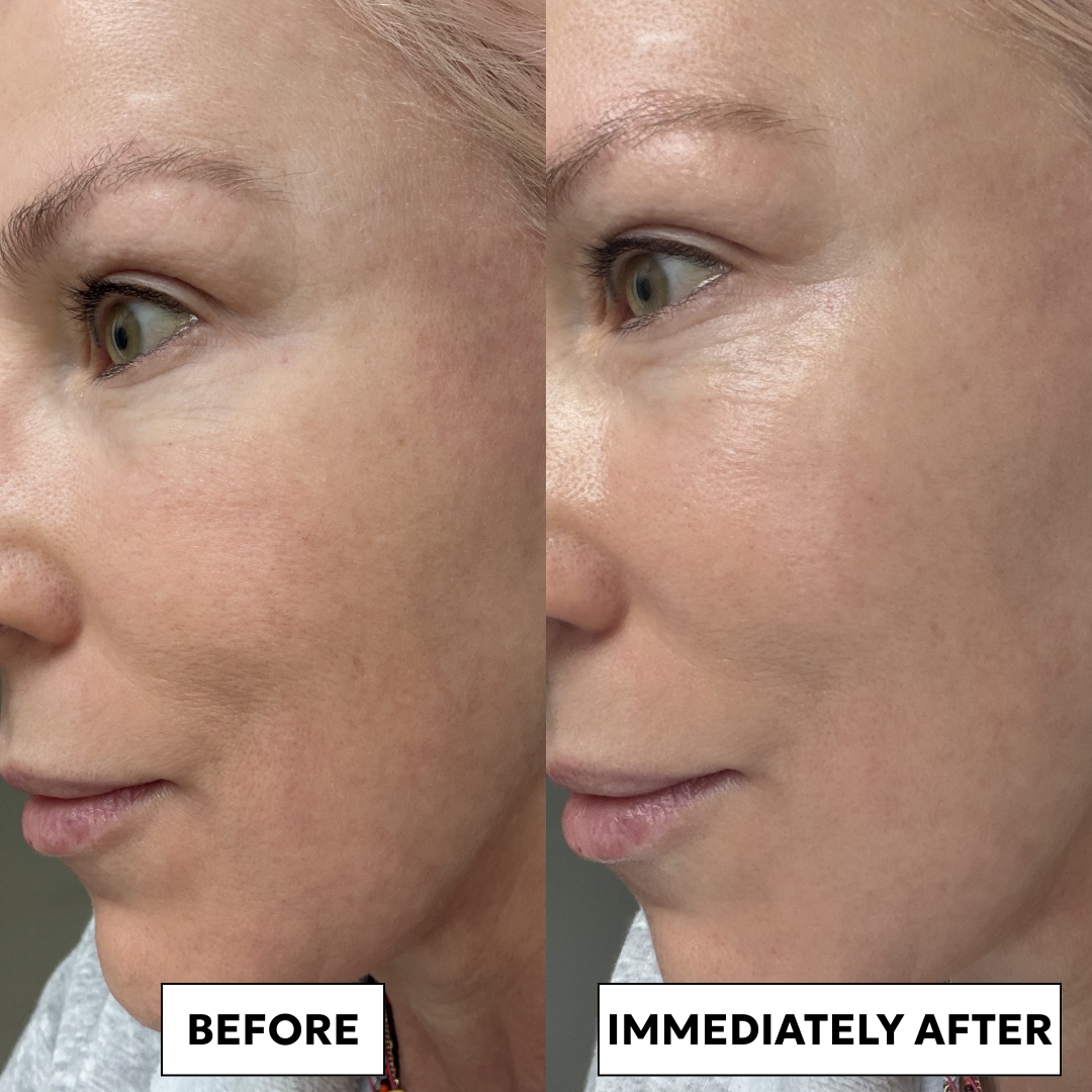 RR Bright Now B&A Square.png
