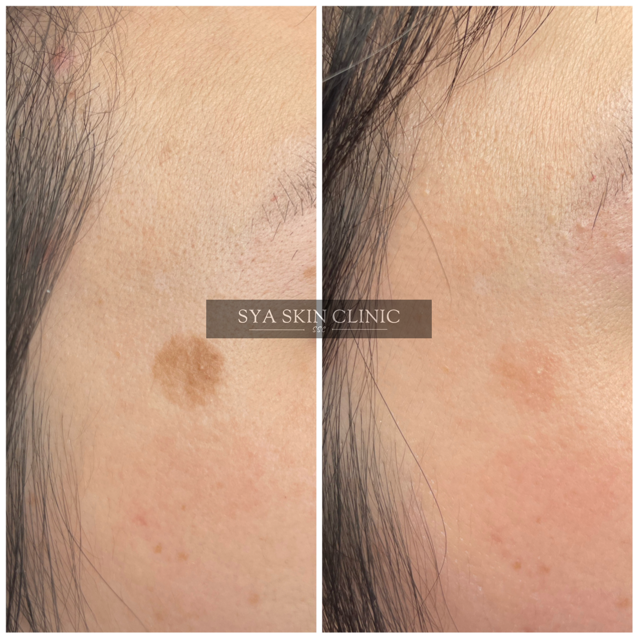 Foto 01-04-2023 17 55 48.png