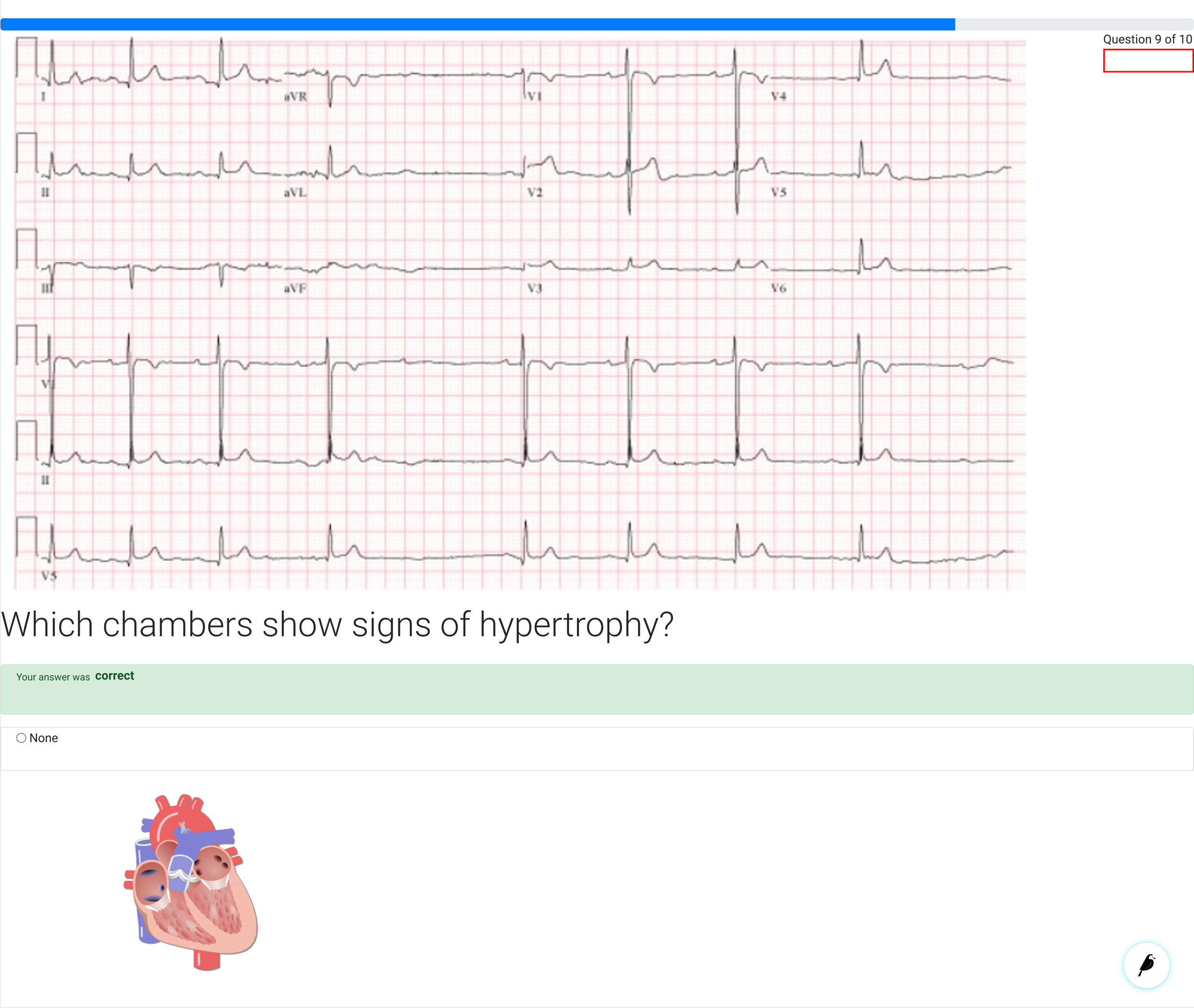Existing Heart Diagram Question (Copy)