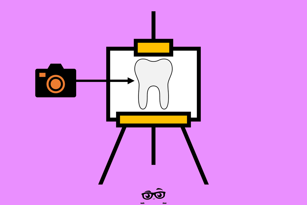 HOW ANDRE ATTACHES IMAGES TO THE CHART IN EAGLESOFT — THE CREW PROCESS