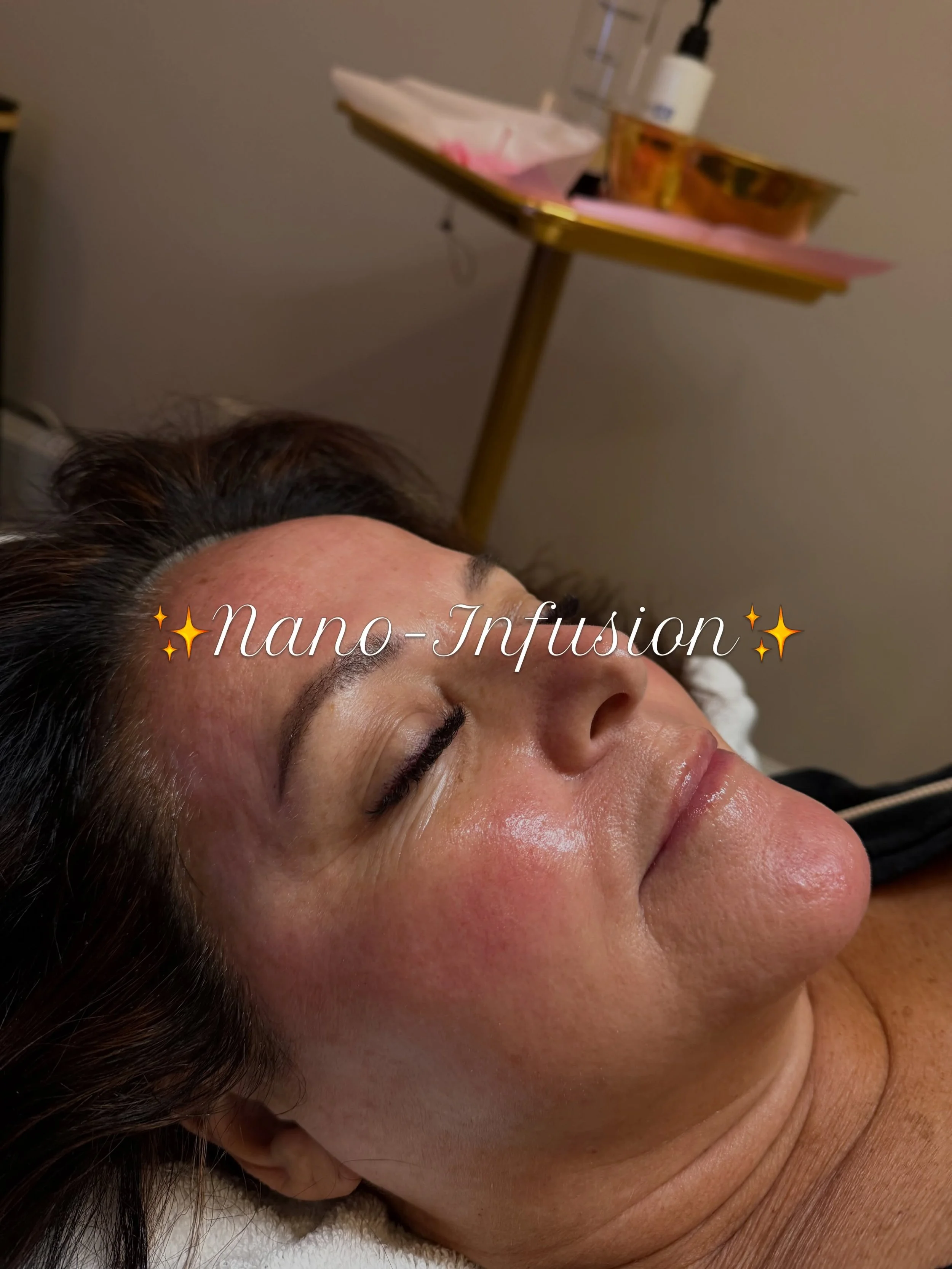 NANO INFUSION ✨ Want smoother, brighter, more hydrated skin? Nano infusion uses specialized nano tips to create superficial microchannels in the skin, helping selected skincare ingredients penetrate the outer skin layers.

This treatment helps improv