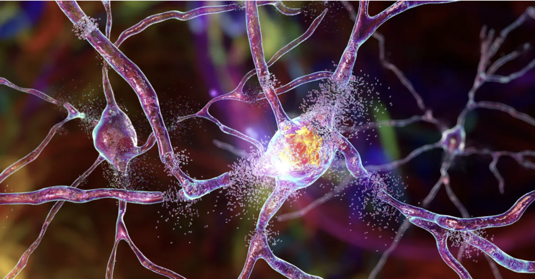 Hope for the Huntington’s Disease Community