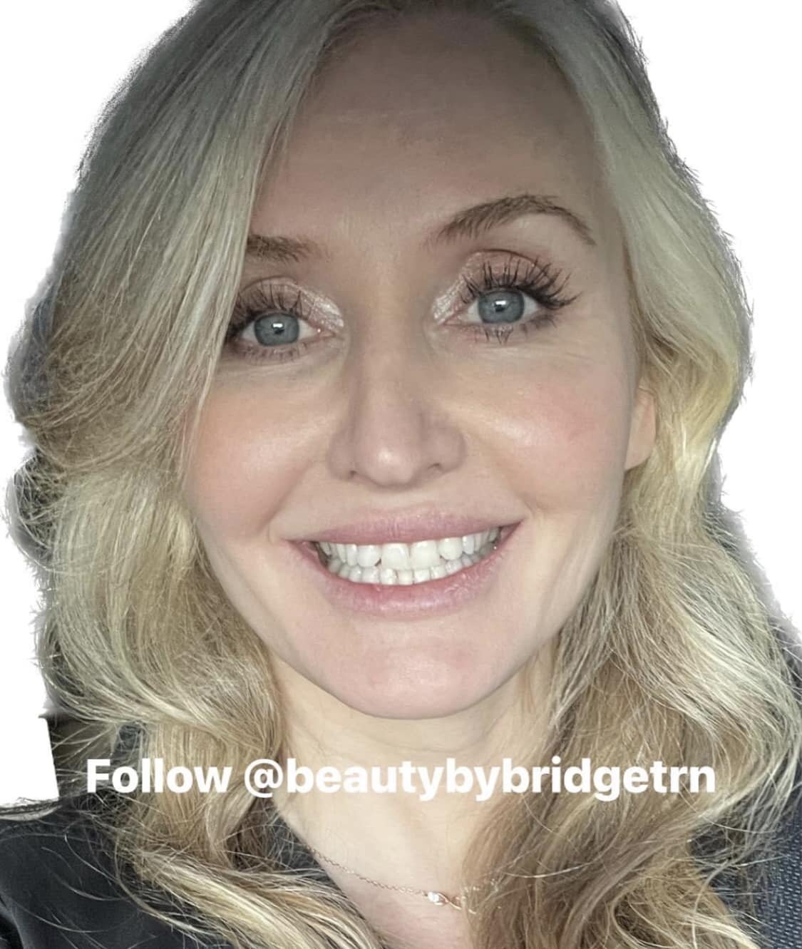 Hi! A face with the name&hellip; I&rsquo;m Bridget, a Cosmetic Nurse injector (RN) and I&rsquo;m so excited about bringing my love of cosmetic procedures to Ellijay!!! If you&rsquo;re tired of driving to Atlanta for your Botox/filler then drive no mo
