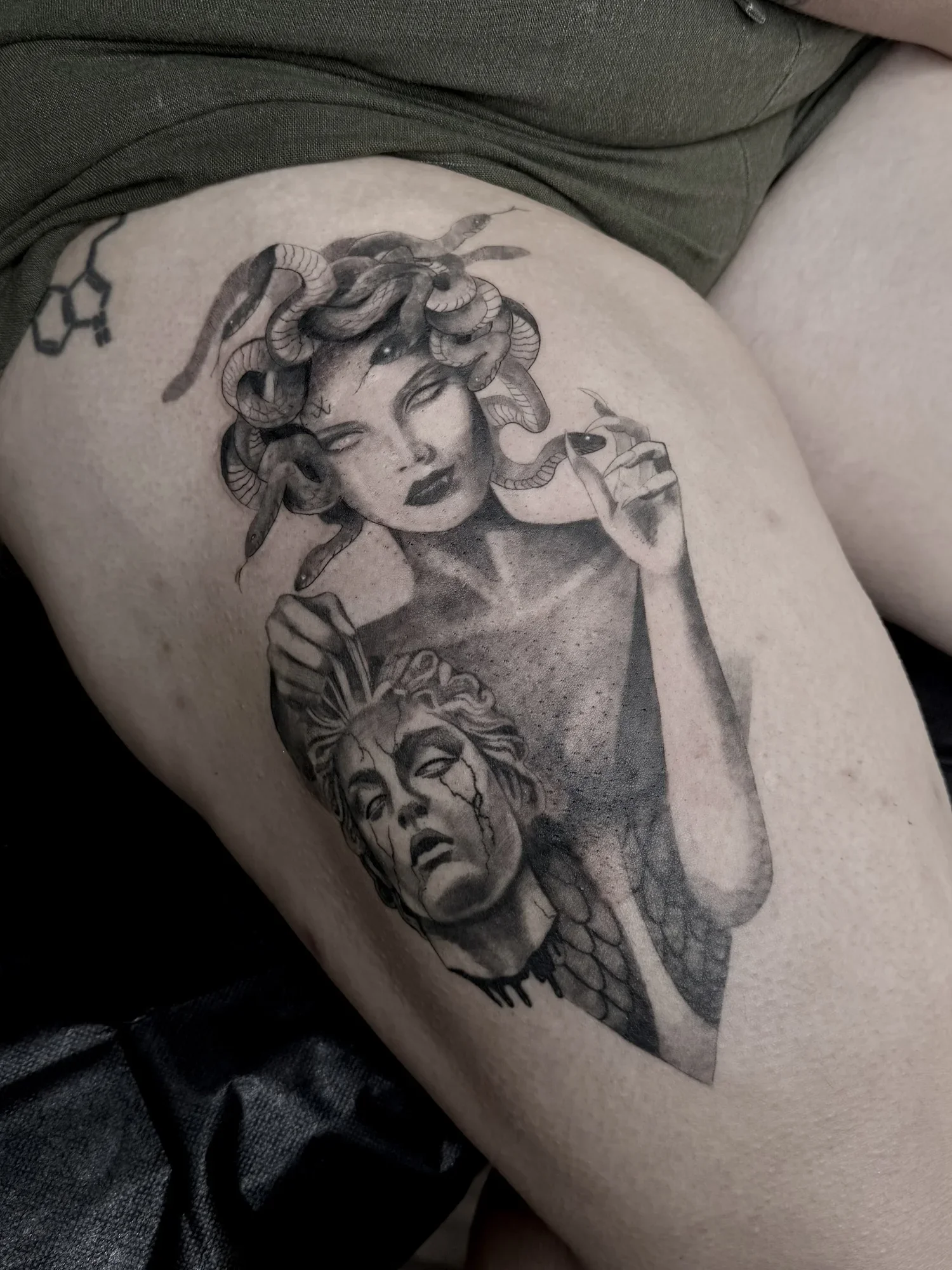 Medusa, thigh · 2 sessions · [blackgrey] [Large]